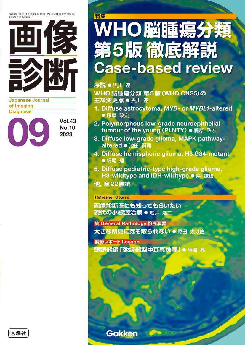 画像診断 Vol.43 No.10（2023年9月号） | 医書.jp