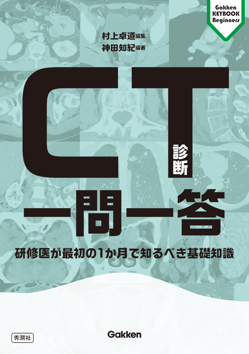 CT診断一問一答 | 医書.jp