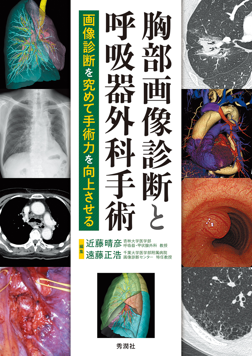 胸部画像診断と呼吸器外科手術 | 医書.jp