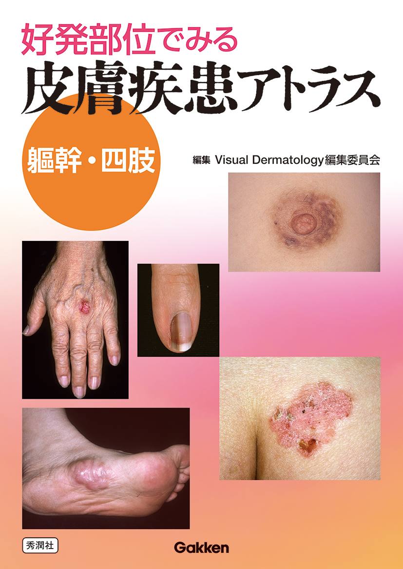 好発部位でみる皮膚疾患アトラス 躯幹・四肢 | 医書.jp