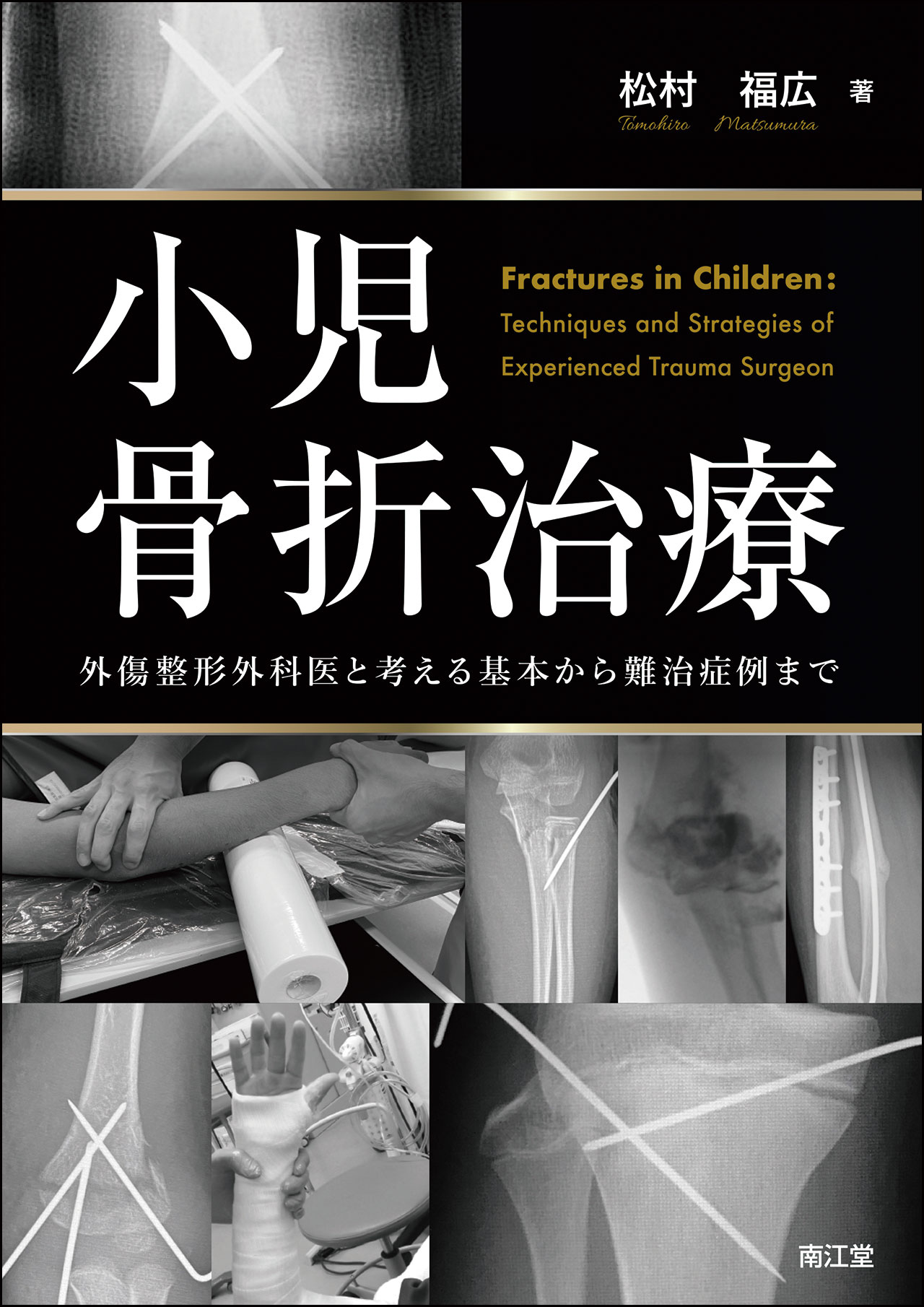 小児骨折治療 | 医書.jp