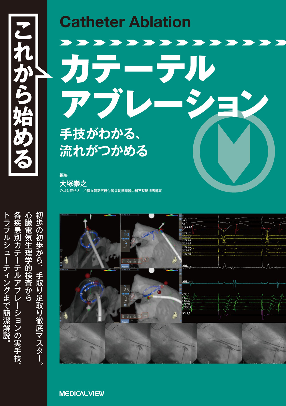 これから始めるカテーテルアブレーション | 医書.jp
