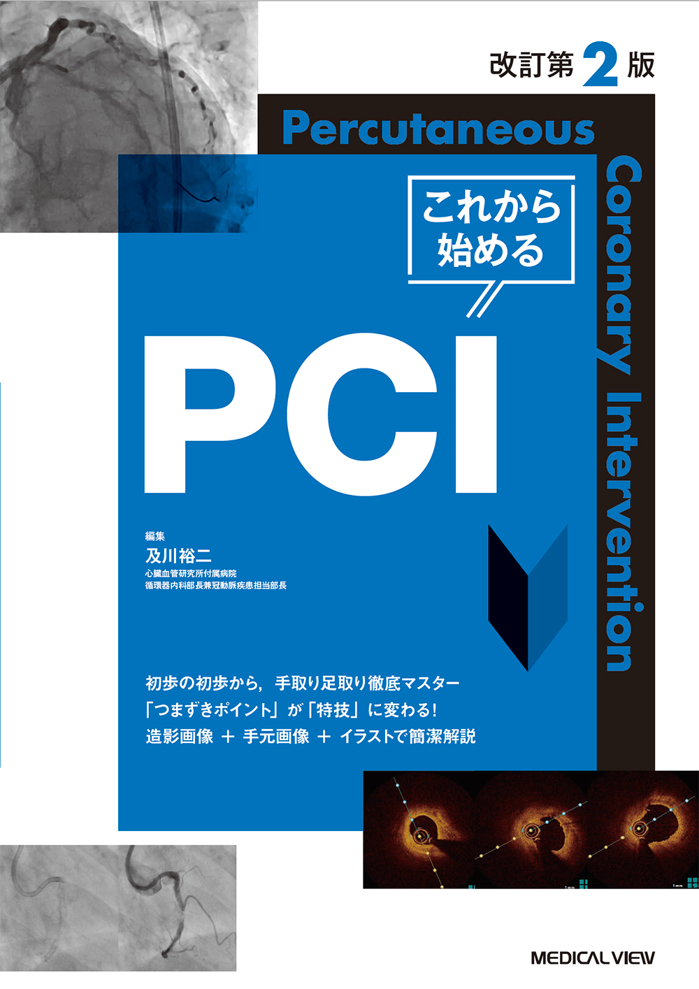 これから始めるPCI 改訂第2版 | 医書.jp