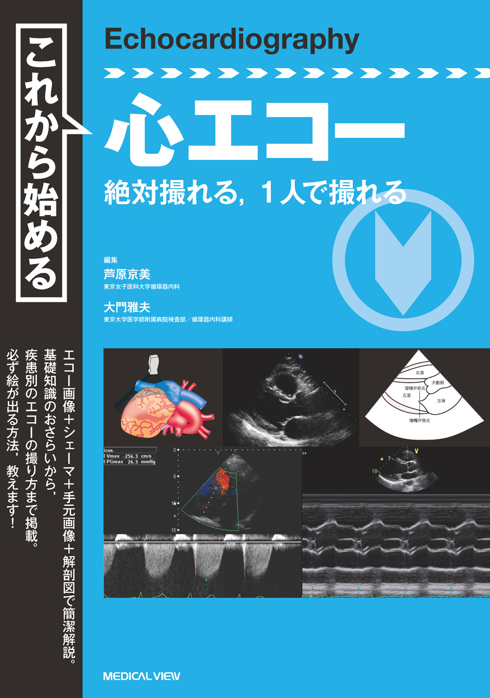 これから始める心エコー | 医書.jp