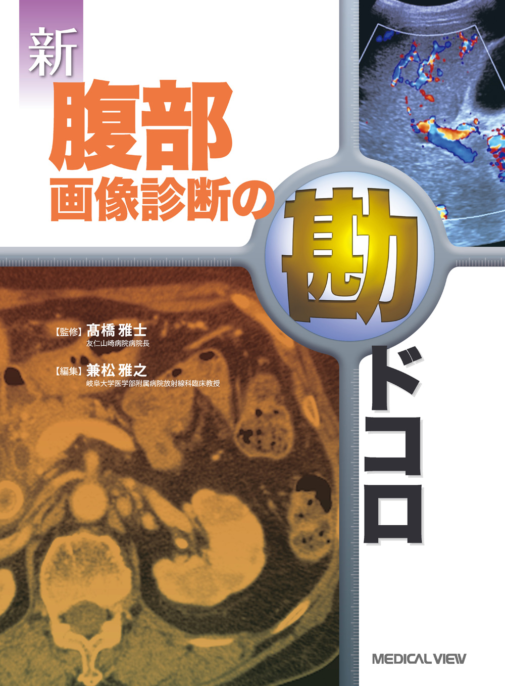 新 腹部画像診断の勘ドコロ | 医書.jp
