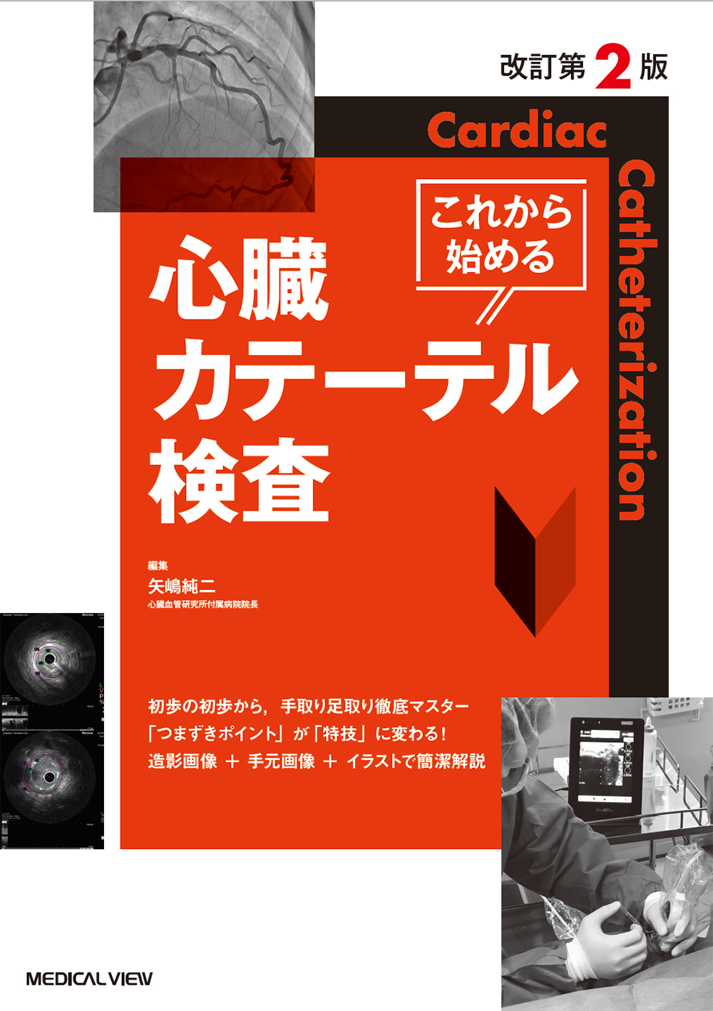 これから始める心臓カテーテル検査 改訂第2版 | 医書.jp