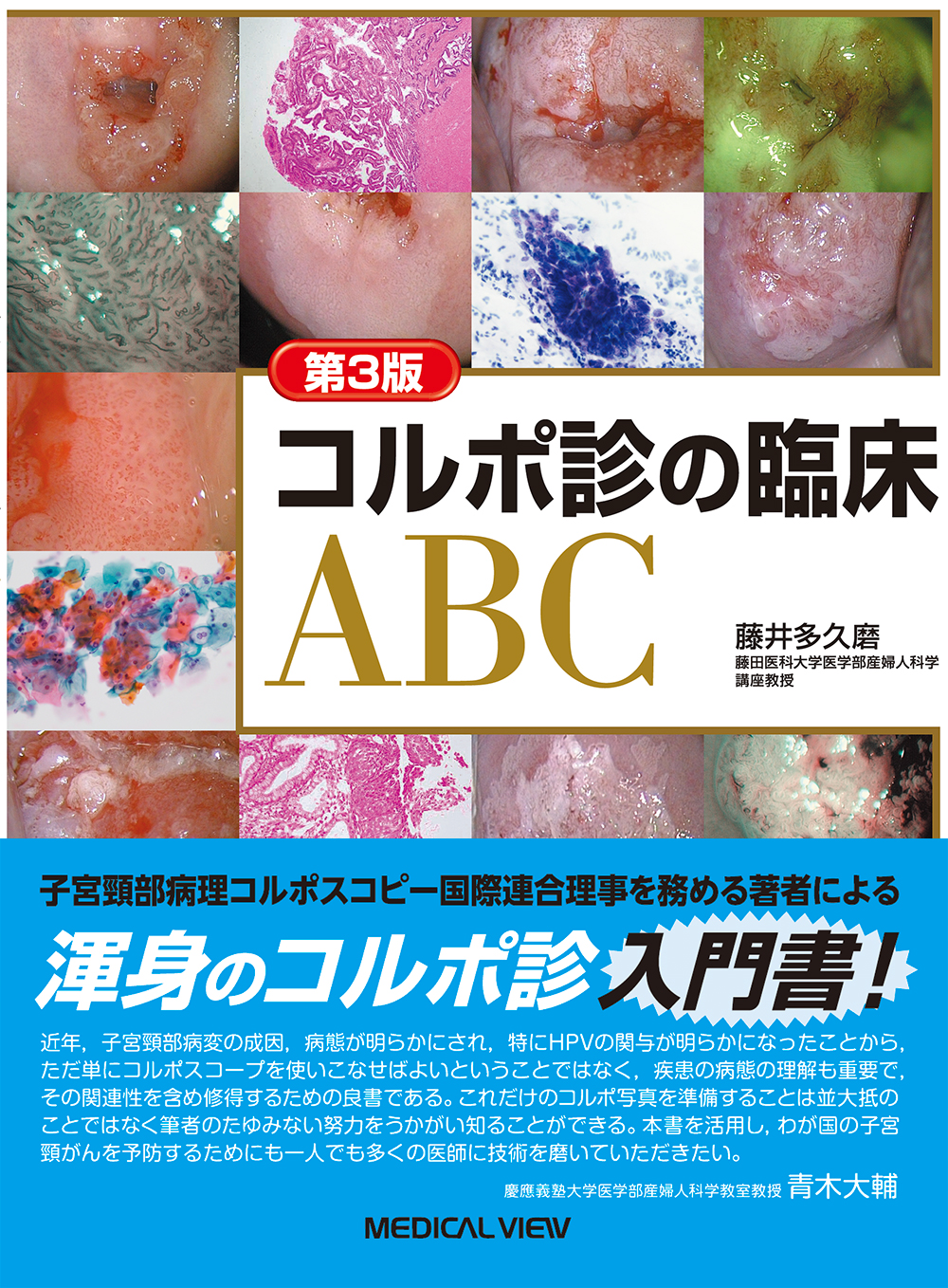 コルポ診の臨床ABC 第3版 | 医書.jp