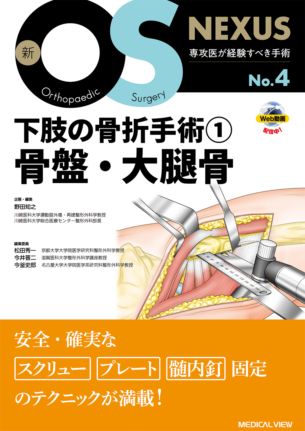 下肢の骨折手術1 骨盤・大腿骨［Web動画付］ | 医書.jp
