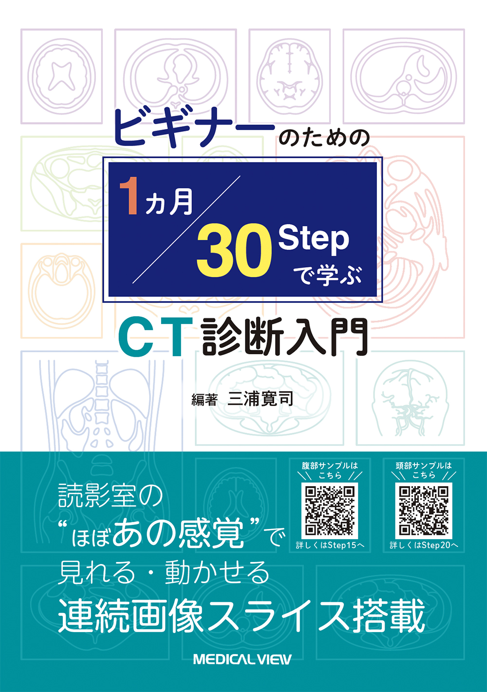 1カ月・30 Stepで学ぶCT診断入門 | 医書.jp