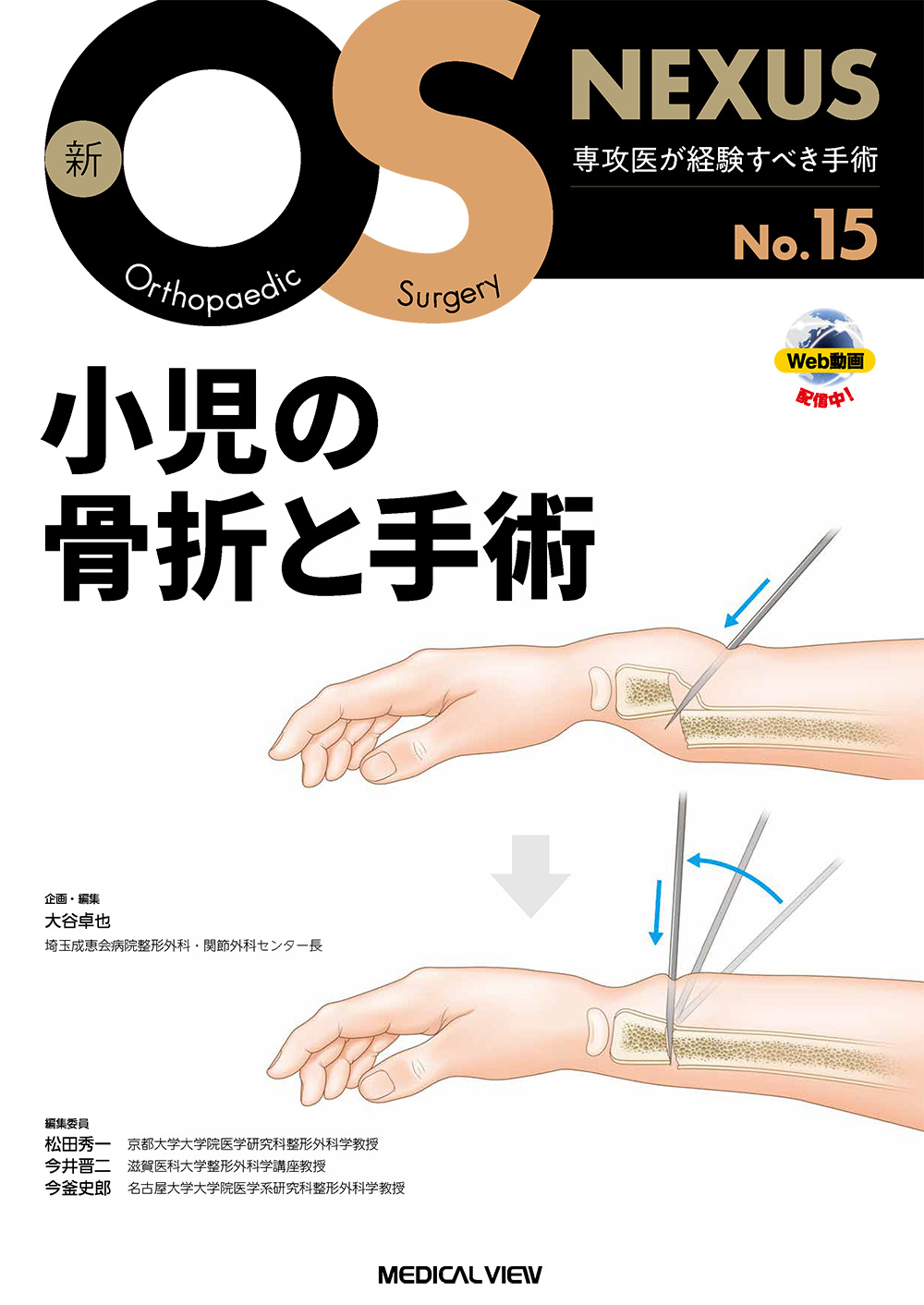 小児の骨折と手術［Web動画付］ | 医書.jp