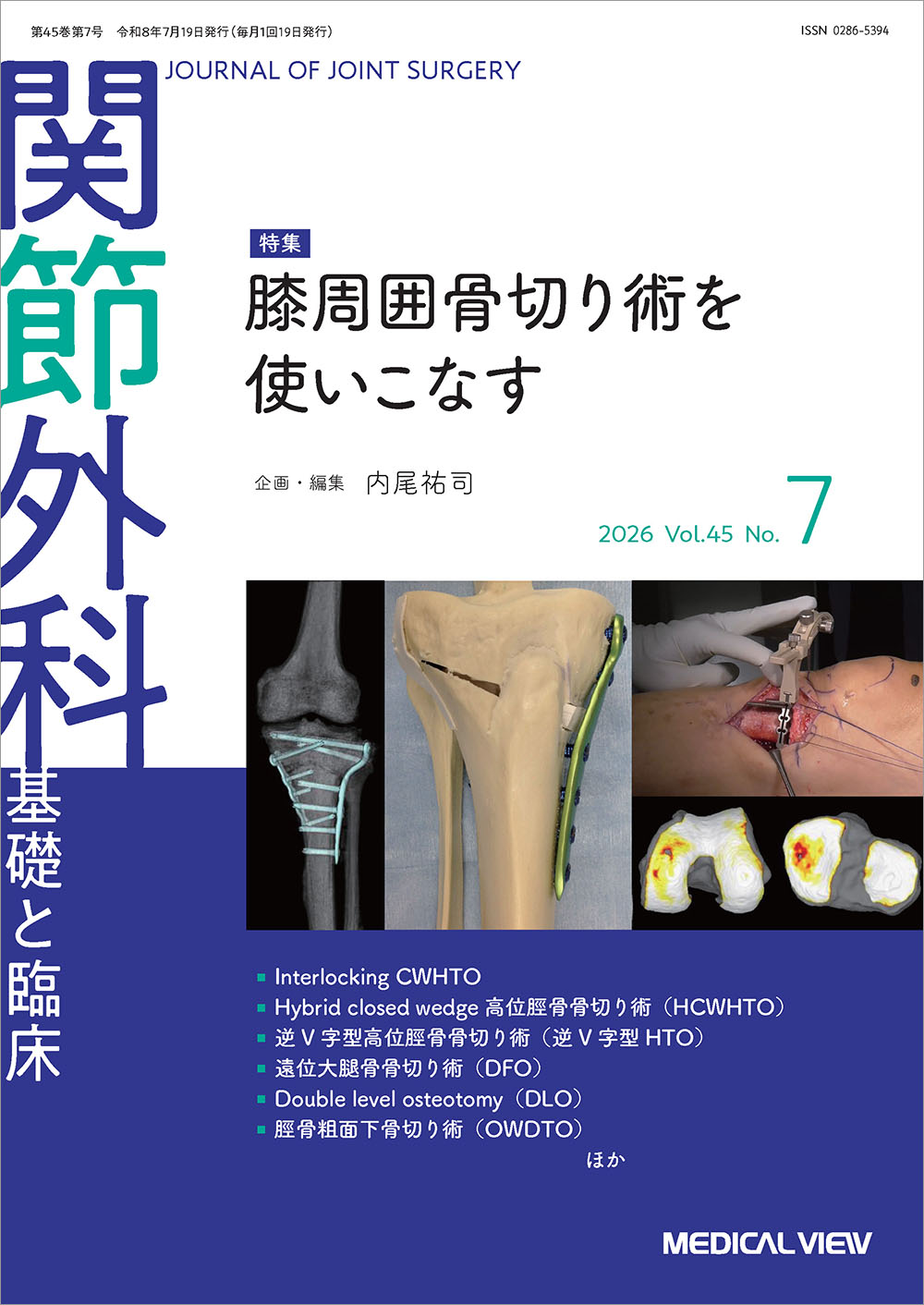 関節外科 基礎と臨床 Vol.45 No.7 | 医書.jp