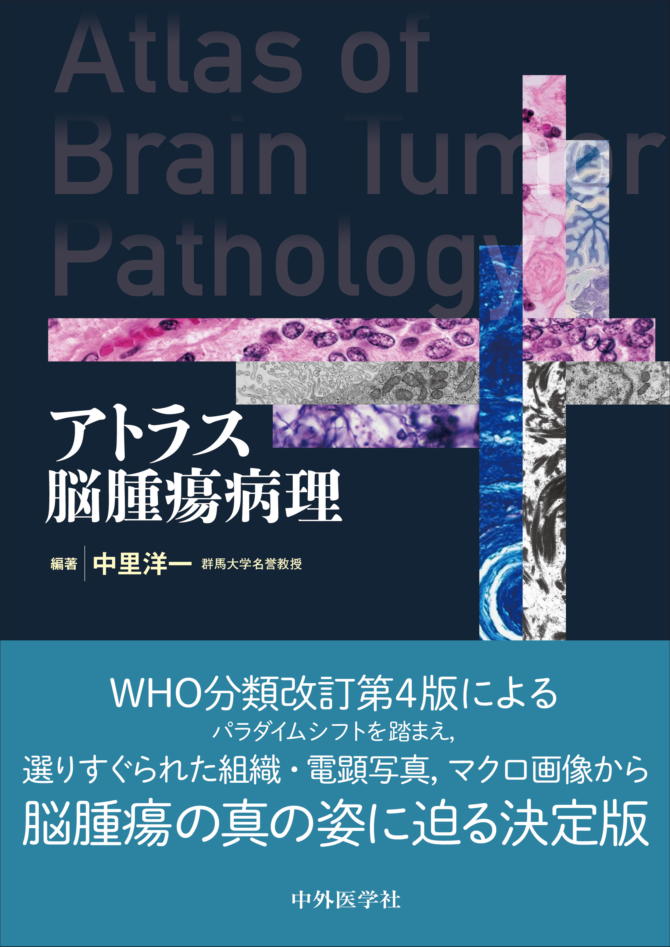 アトラス脳腫瘍病理 | 医書.jp