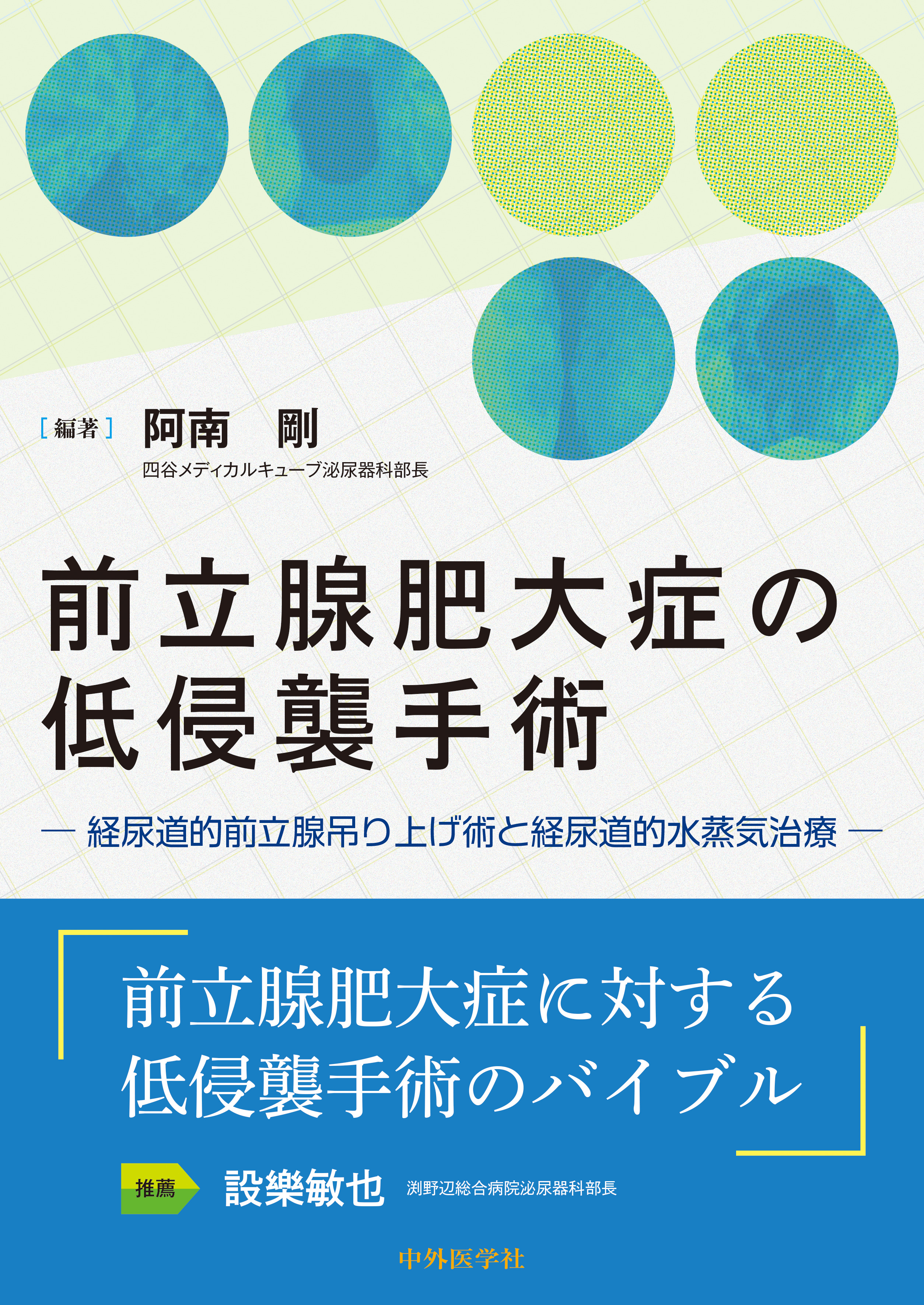 前立腺肥大症の低侵襲手術 ―経尿道的前立腺吊り上げ術と経尿道的水蒸気