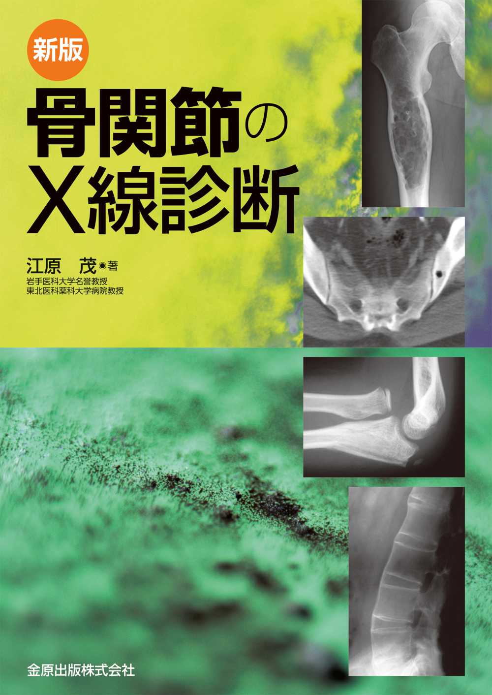 大系 骨・関節の画像診断 I・II 2冊セット 新版 骨関節のX線診断 | 医書.jp