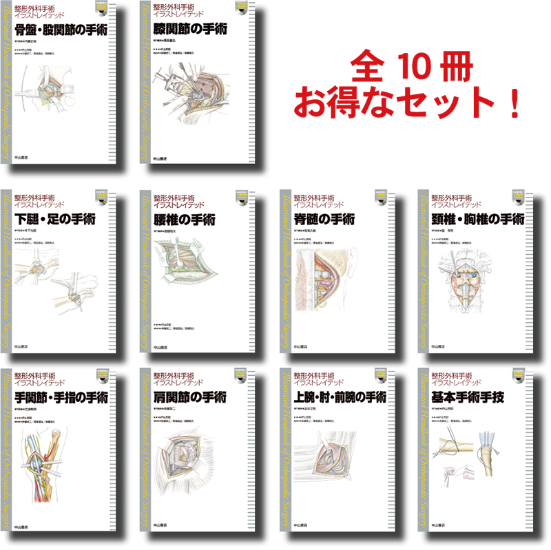 整形外科手術イラストレイテッド 膝関節の手術 【裁断済み】 整形外科手術イラストレイテッド セット | 医書.jp