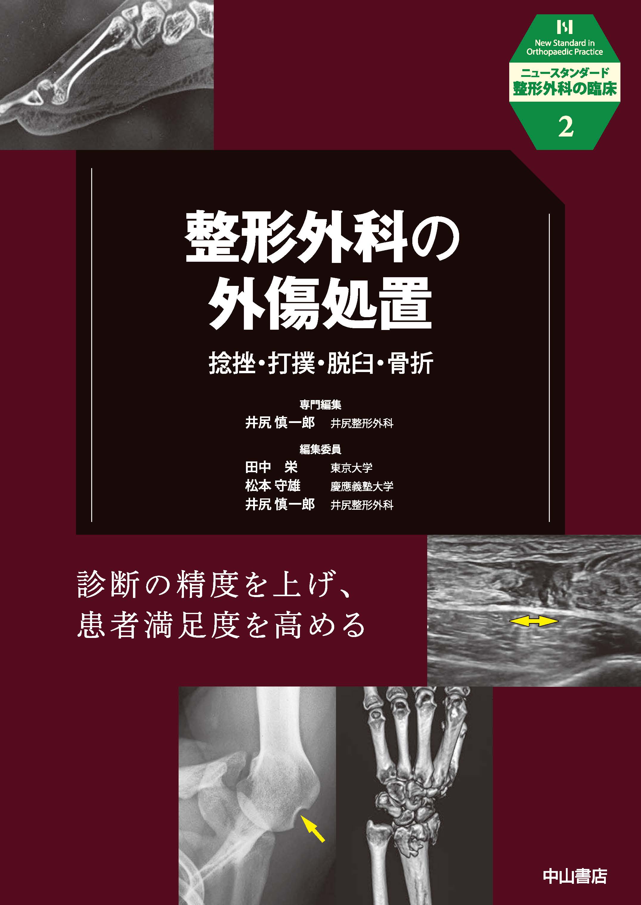 整形外科の外傷処置 捻挫・打撲・脱臼・骨折 | 医書.jp