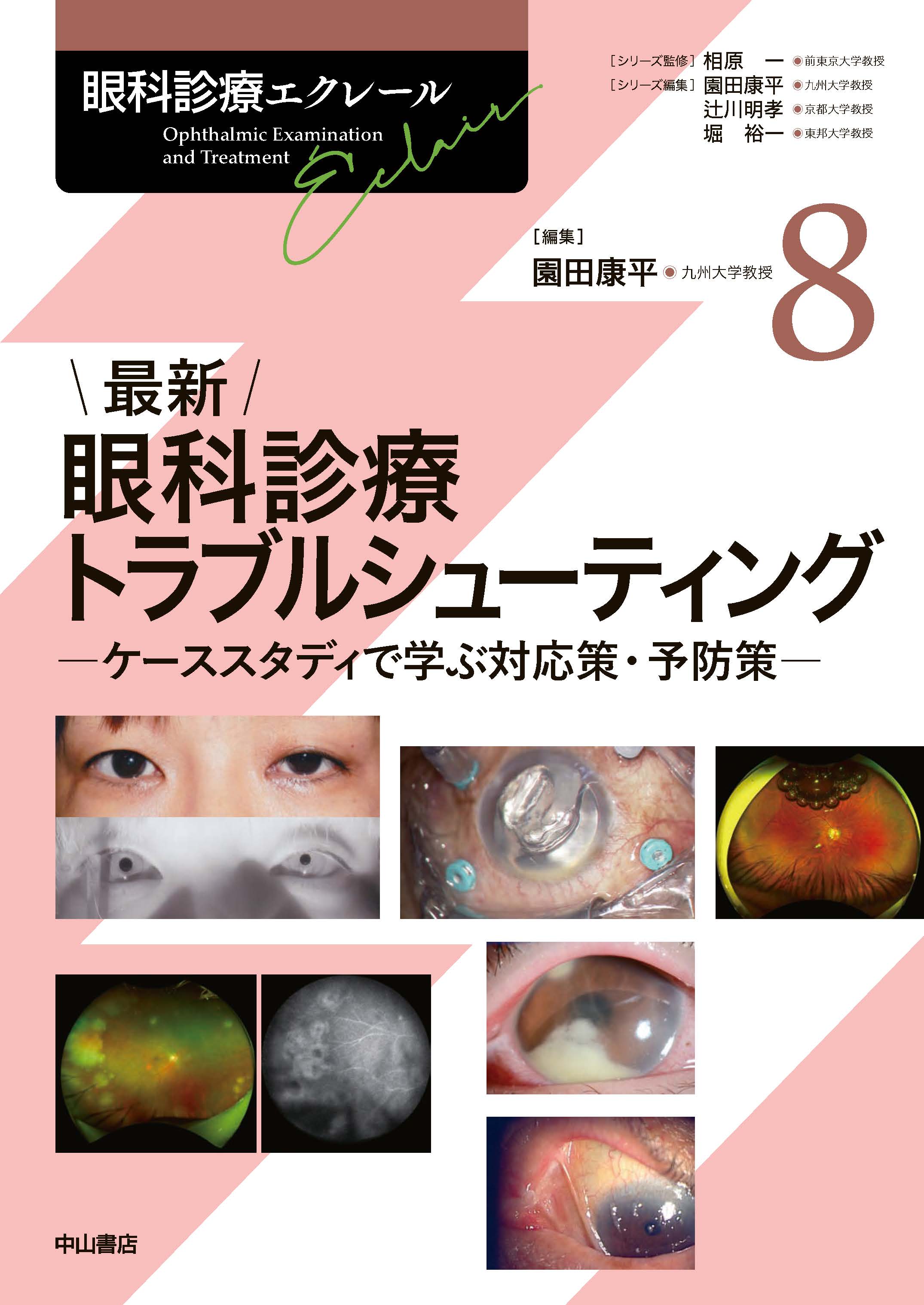 最新 眼科診療トラブルシューティング | 医書.jp