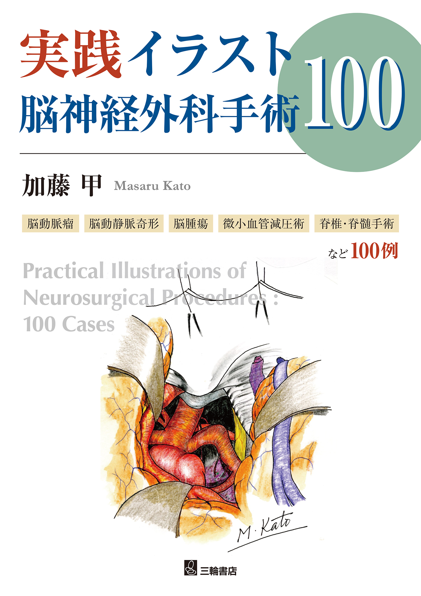 実践イラスト脳神経外科手術100 | 医書.jp
