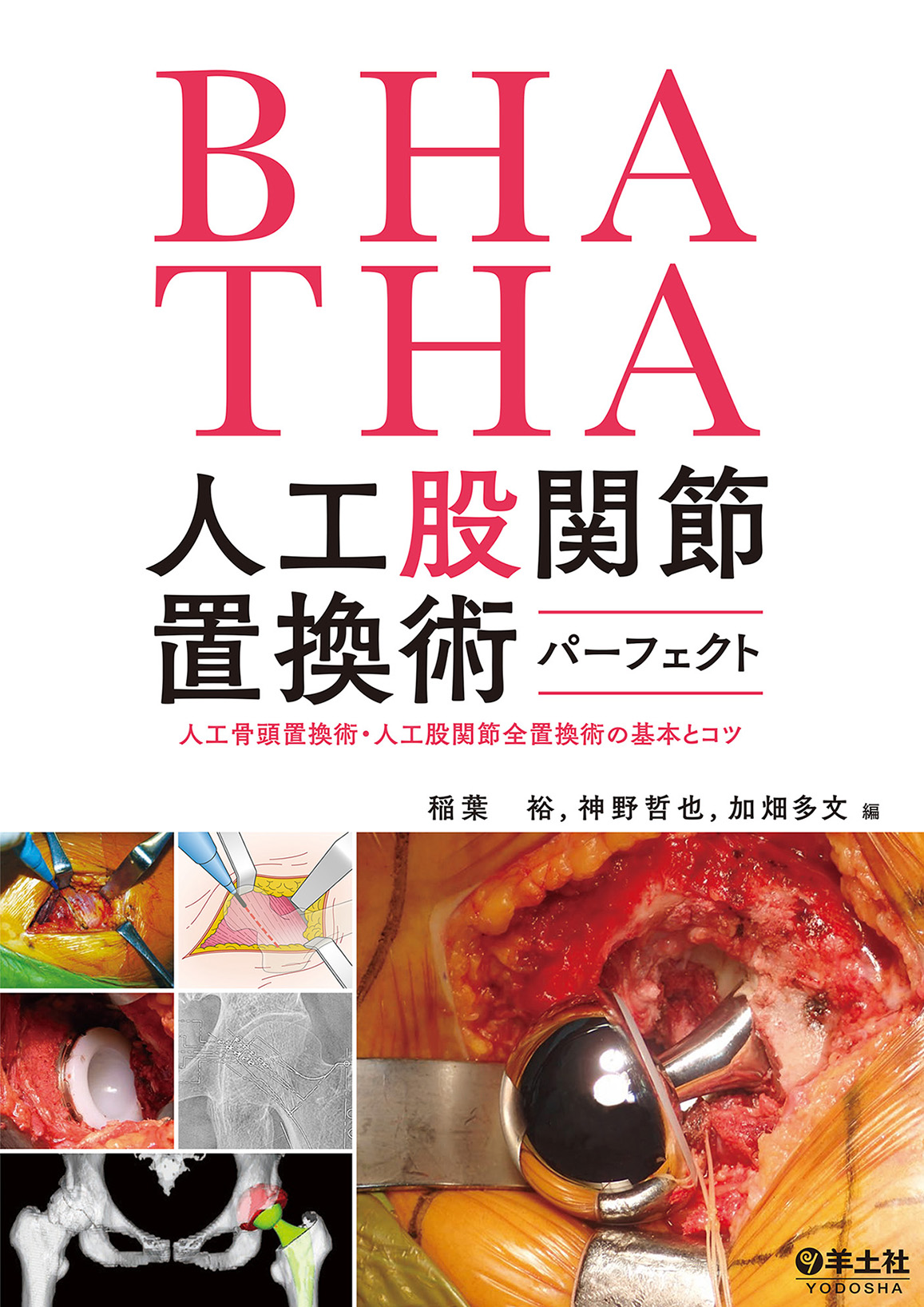 BHA・THA 人工股関節置換術パーフェクト BHA・THA 人工股関節置換術パーフェクト | 医書.jp