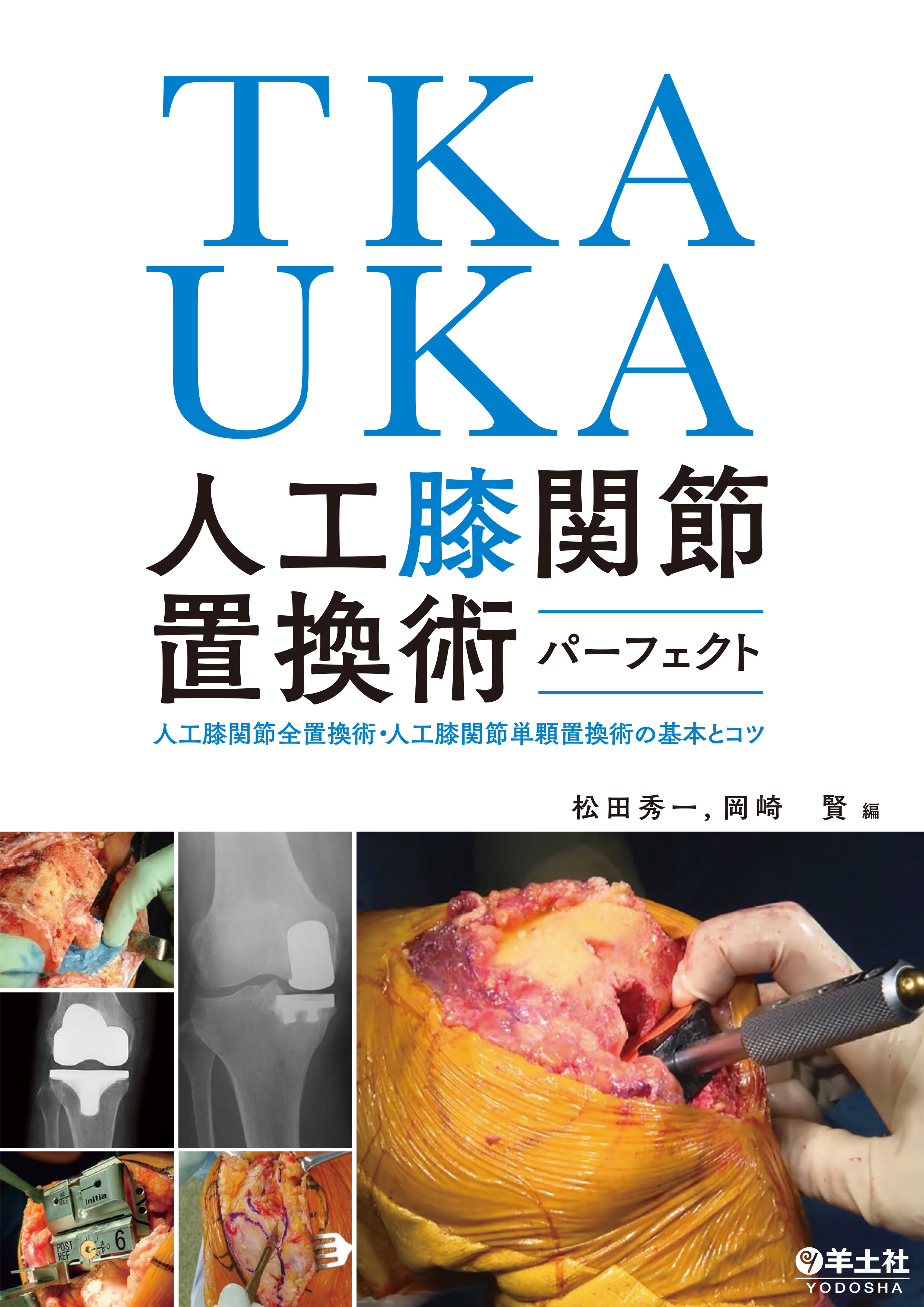 TKA・UKA 人工膝関節置換術パーフェクト | 医書.jp