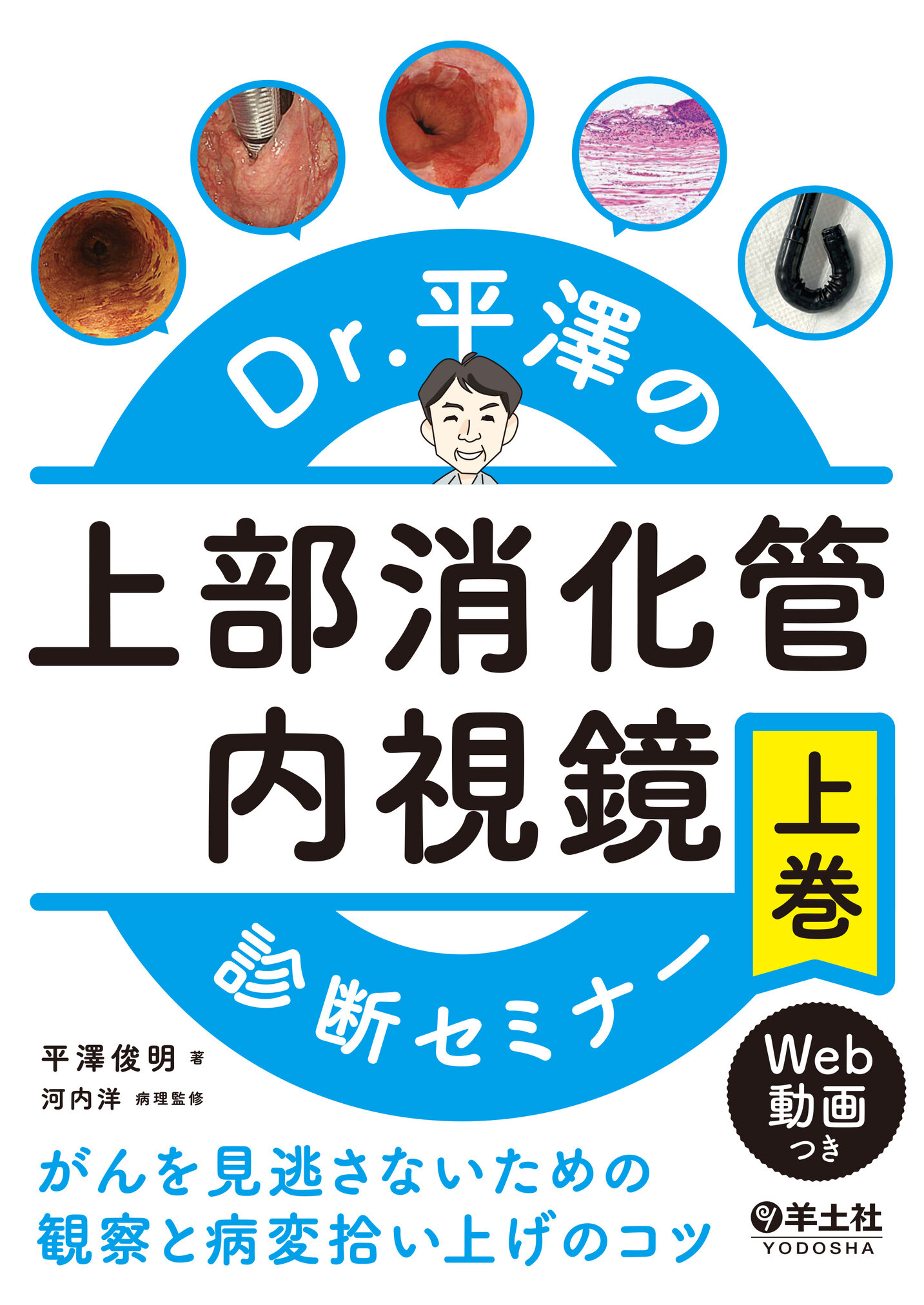 【裁断済み】Dr.平澤の上部消化管内視鏡診断セミナー 上巻・下巻 Dr.平澤の上部消化管内視鏡診断セミナー 上巻 | 医書.jp