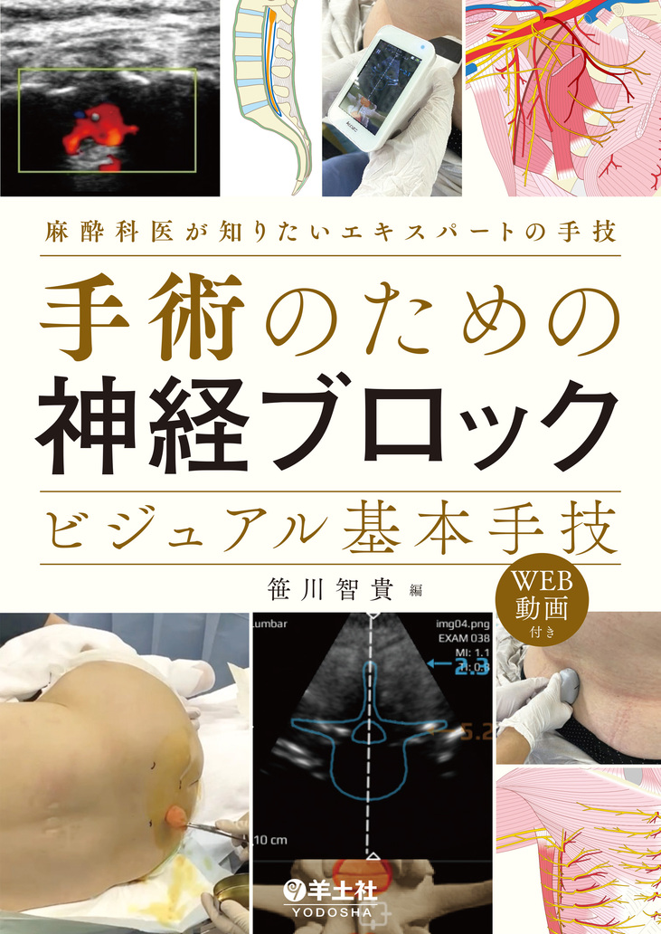 手術のための神経ブロック ビジュアル基本手技 | 医書.jp