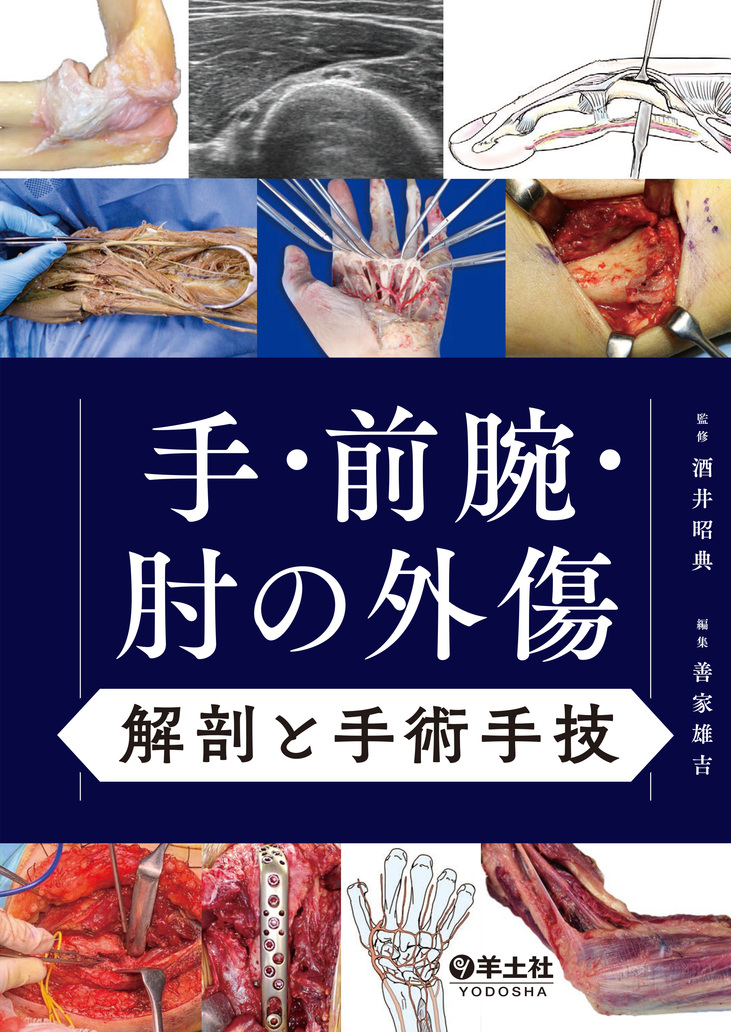 手・前腕・肘の外傷 解剖と手術手技 | 医書.jp