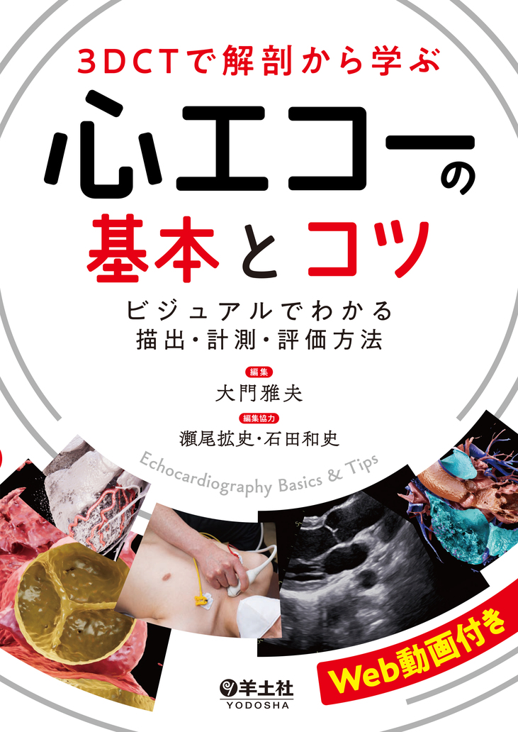 3DCTで解剖から学ぶ心エコーの基本とコツ | 医書.jp