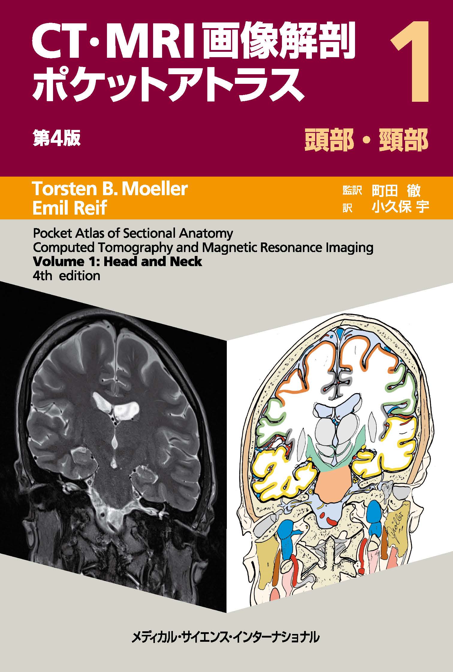 MVP CT/MRIアトラス 裁断済 CT・MRI画像解剖ポケットアトラス 第4版 1巻 頭部・頸部 | 医書.jp