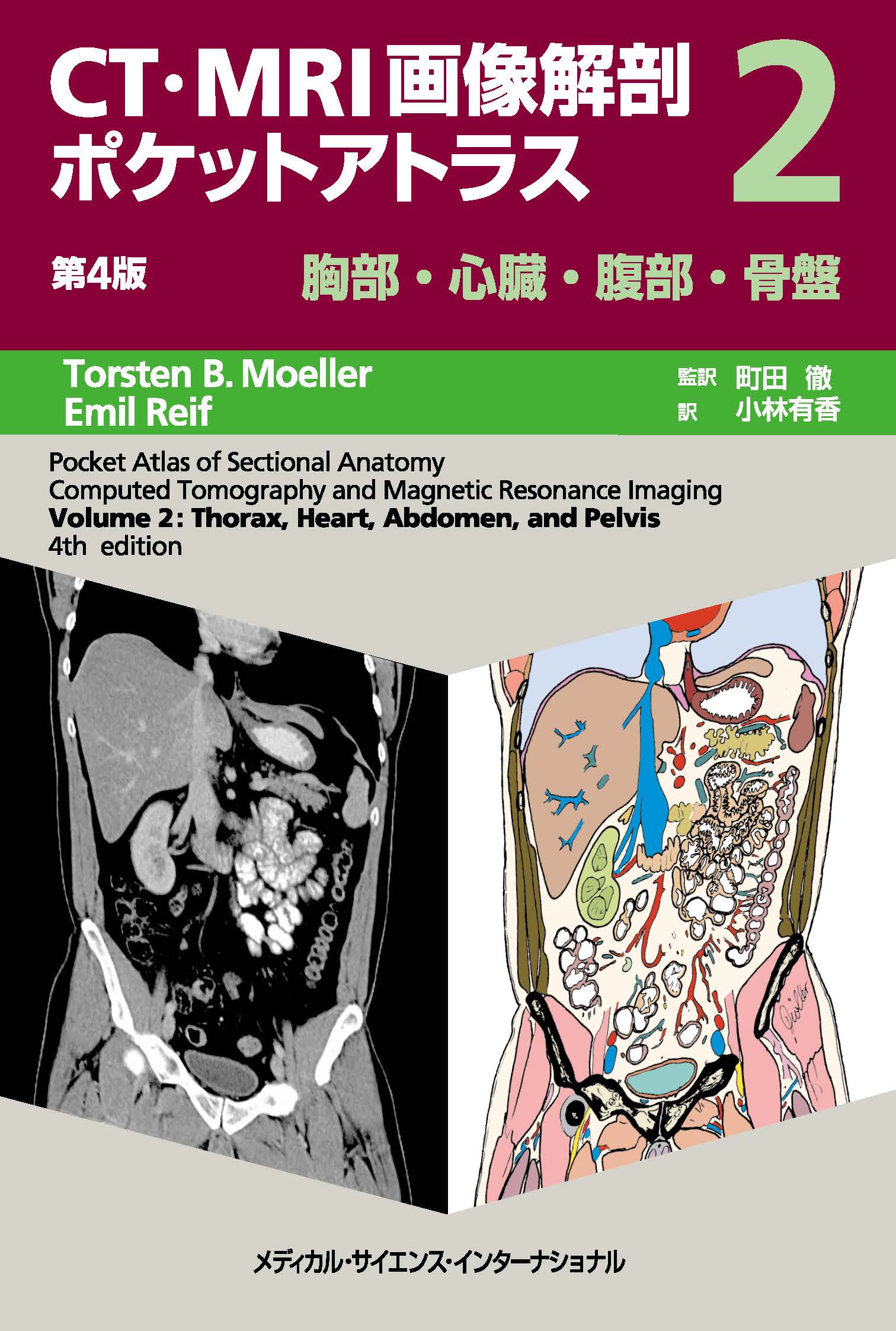 CT・MRI画像解剖ポケットアトラス 第4版 2巻 胸部・心臓・腹部・骨盤