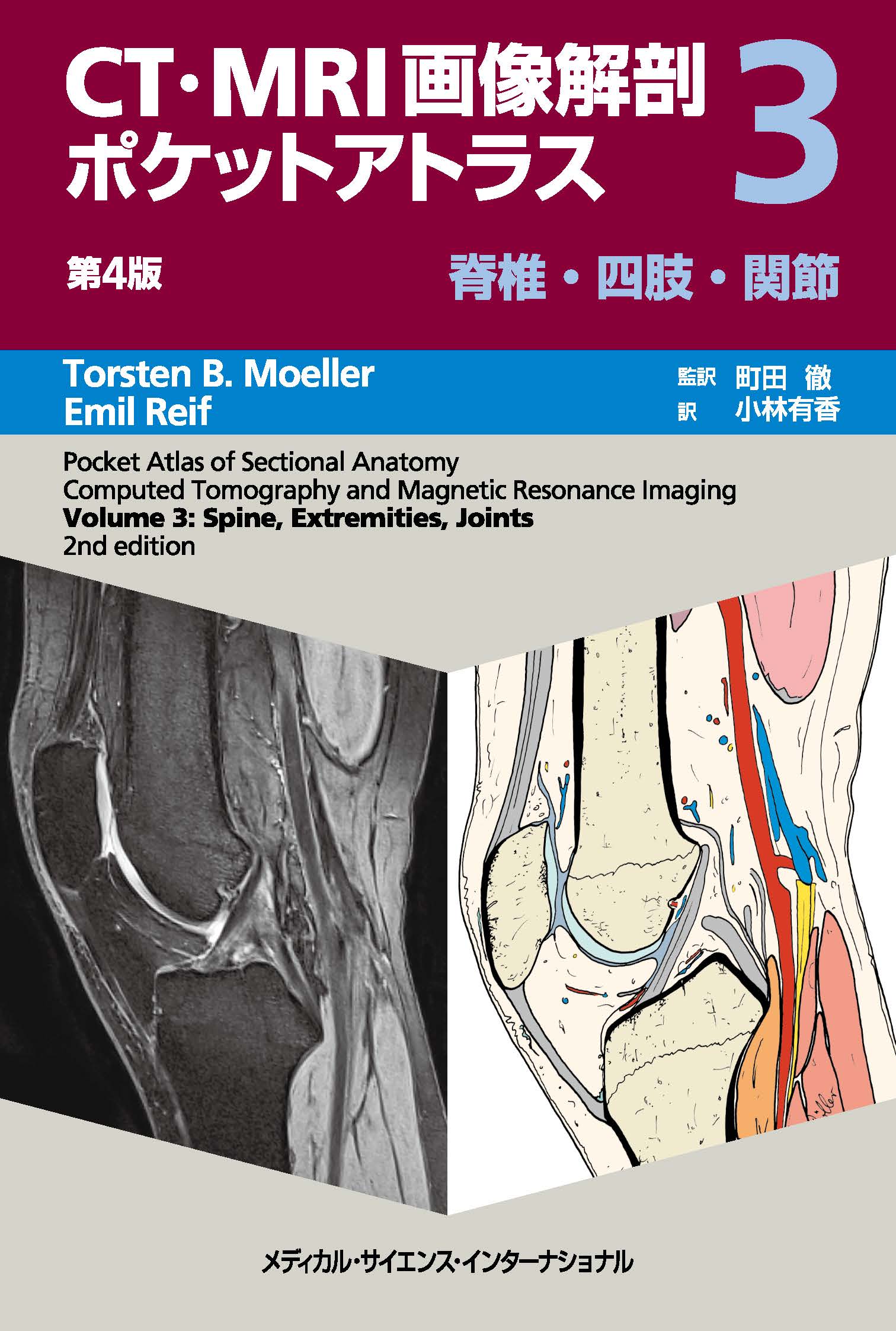CT・MRI画像解剖ポケットアトラス 第4版 3巻 脊椎・四肢・関節 | 医書.jp