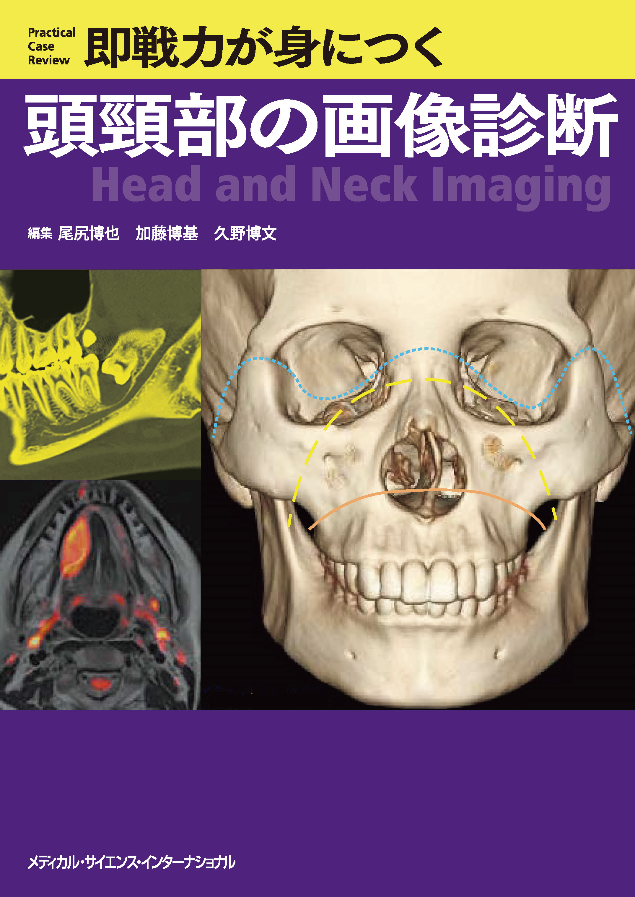 即戦力が身につく頭頸部の画像診断 | 医書.jp