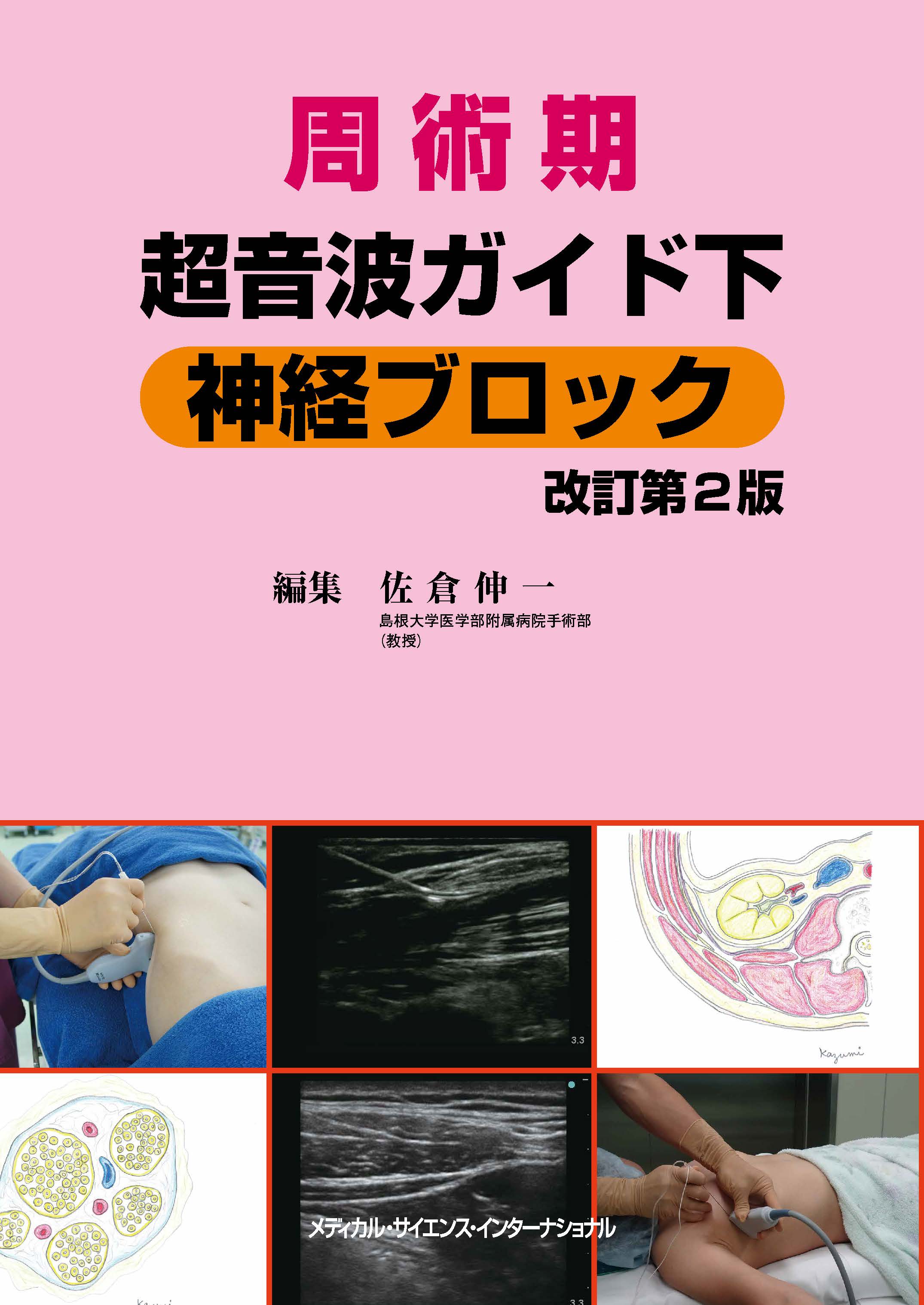 周術期 超音波ガイド下 神経ブロック 改訂第2版 周術期超音波ガイド下神経ブロック 改訂第 2 版 | 医書.jp