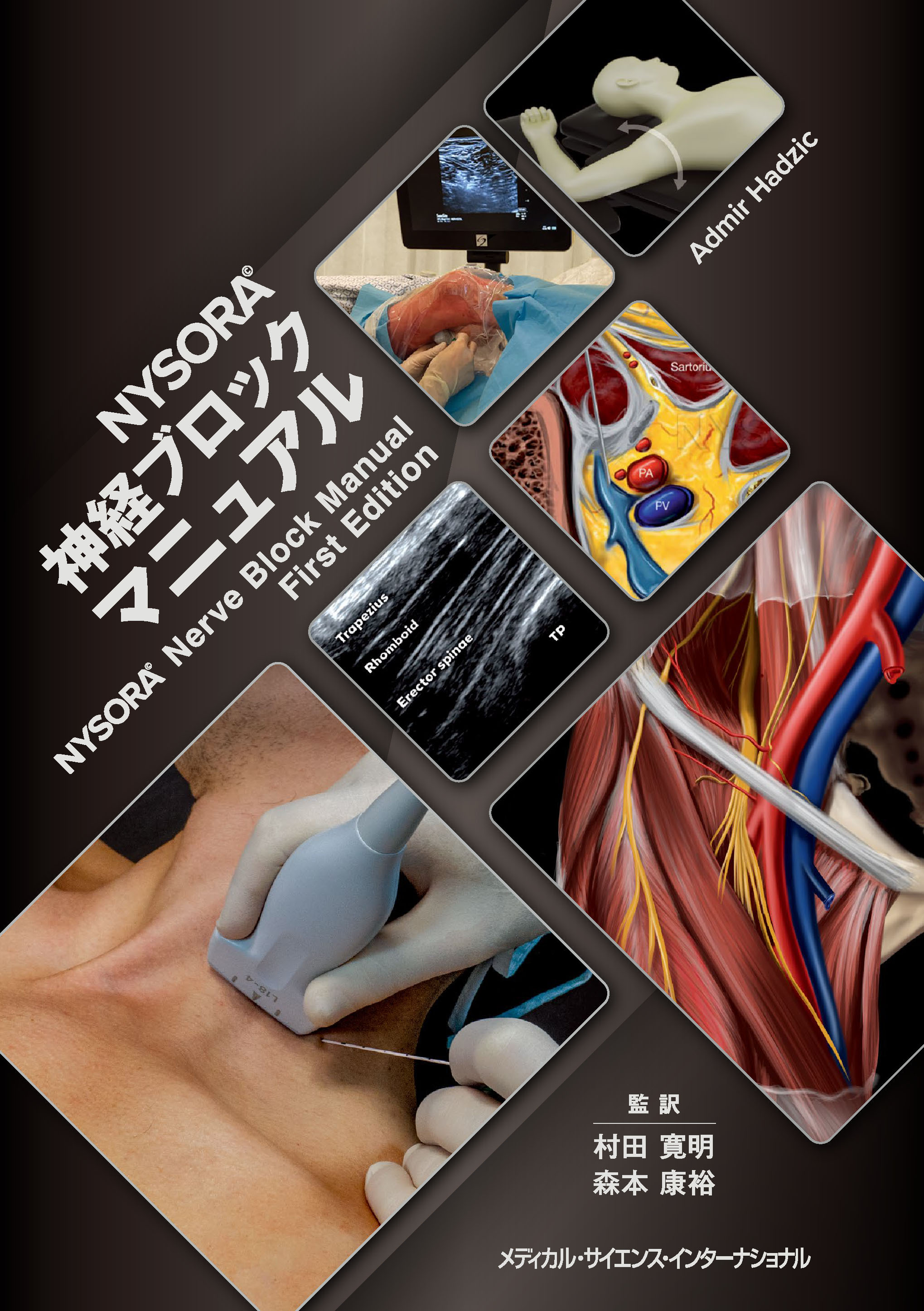 NYSORA神経ブロックマニュアル | 医書.jp