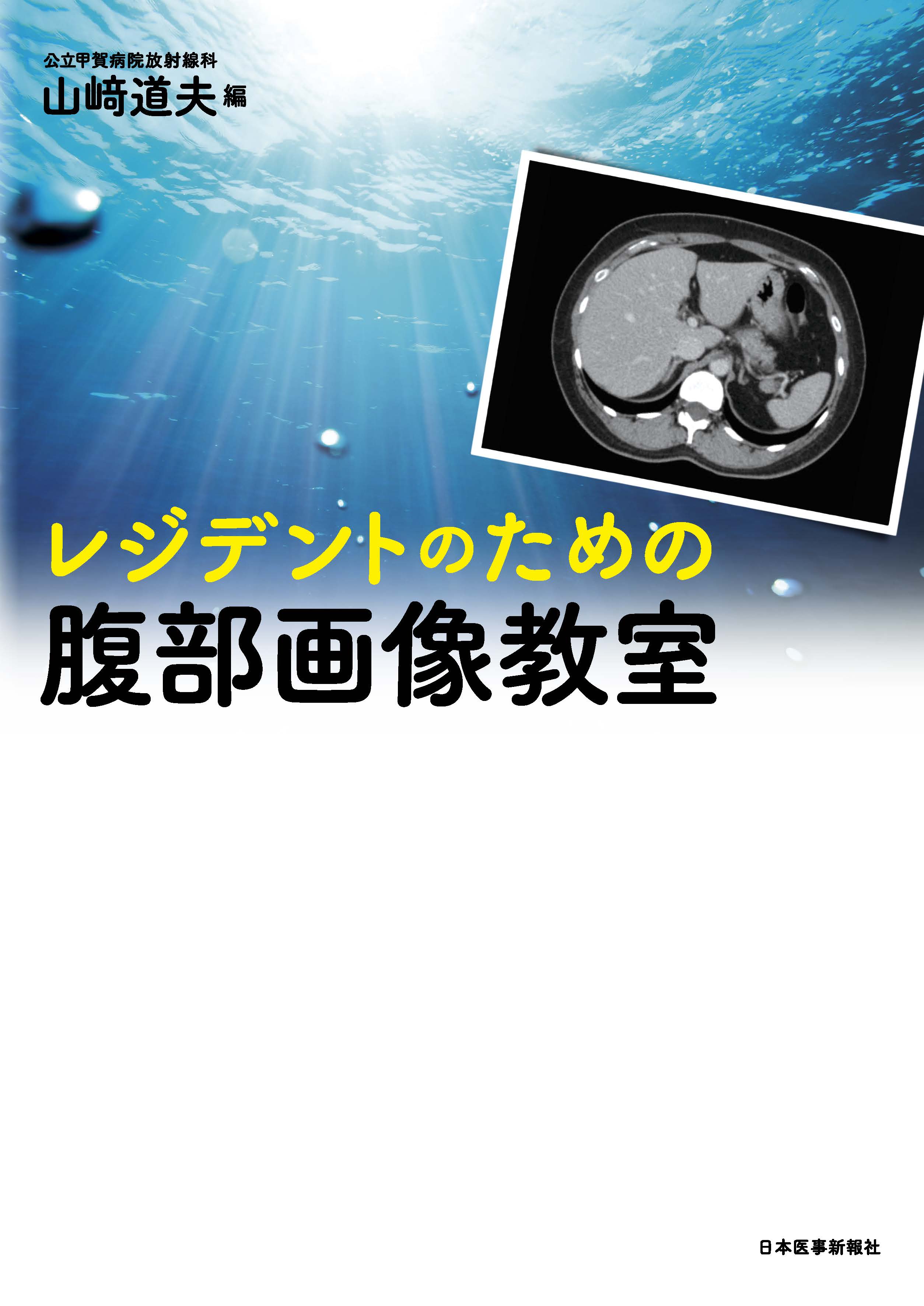 レジデントのための腹部画像教室 | 医書.jp