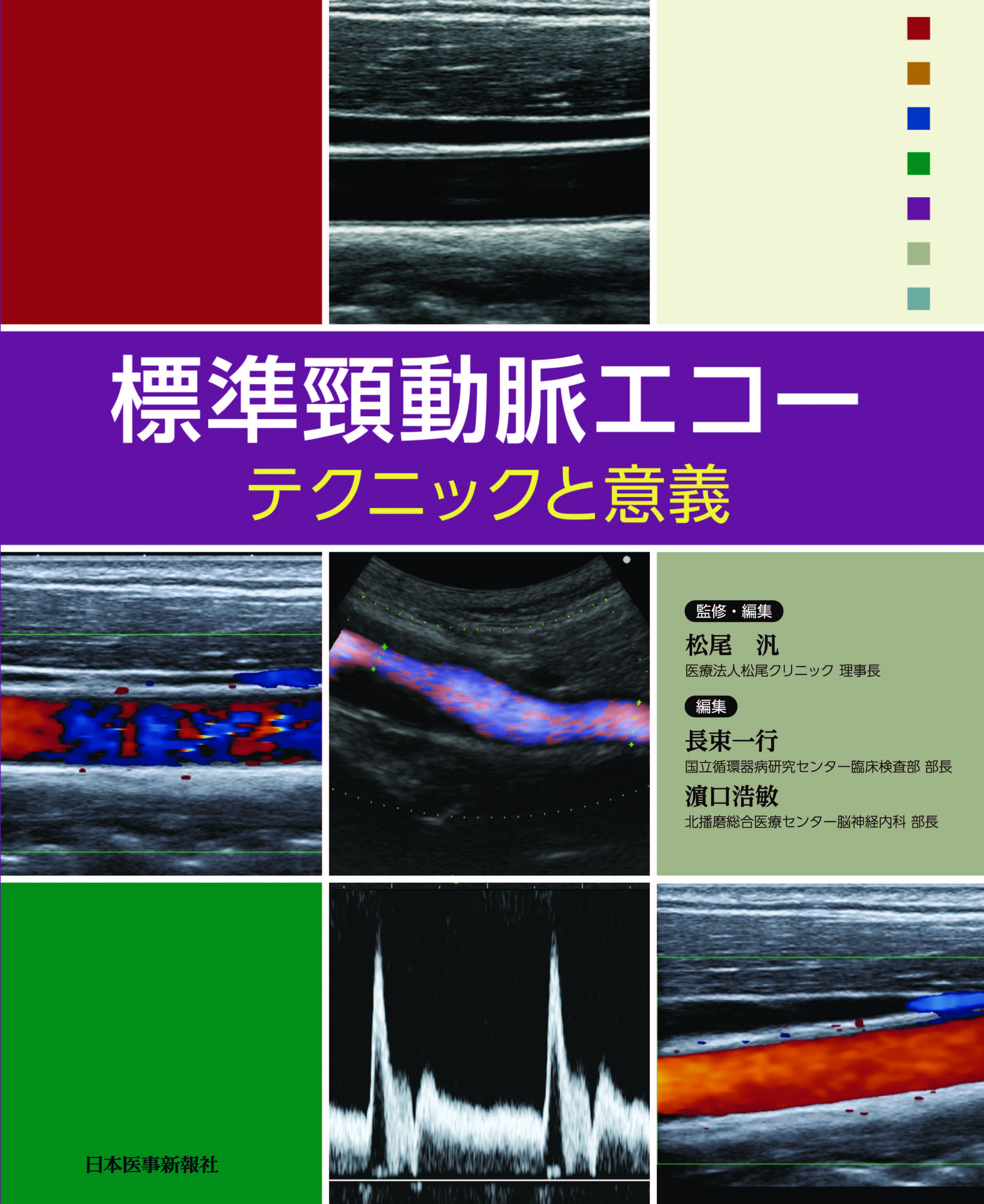 標準頸動脈エコー | 医書.jp