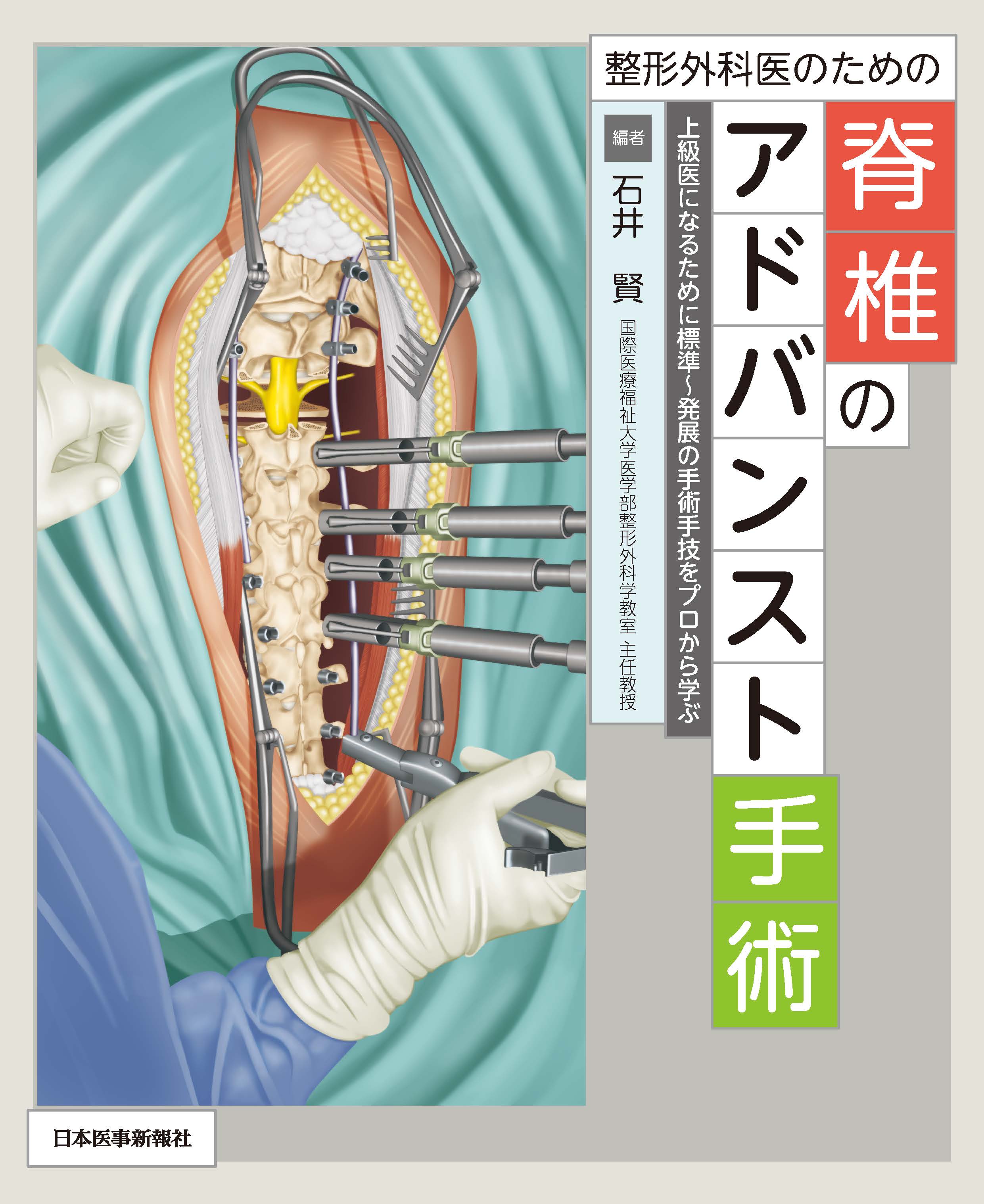 整形外科医のための脊椎のアドバンスト手術 | 医書.jp