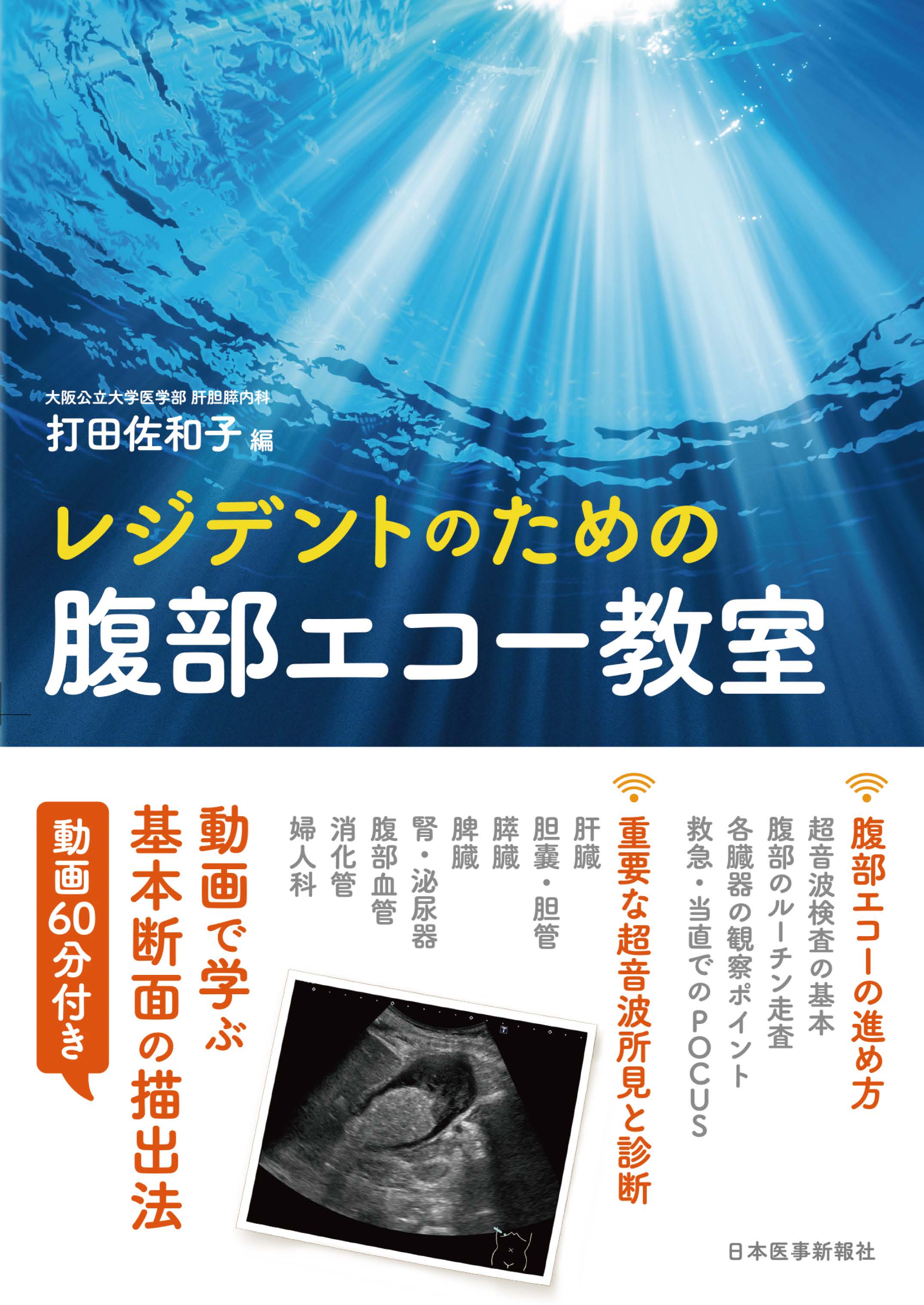 レジデントのための腹部エコー教室 | 医書.jp