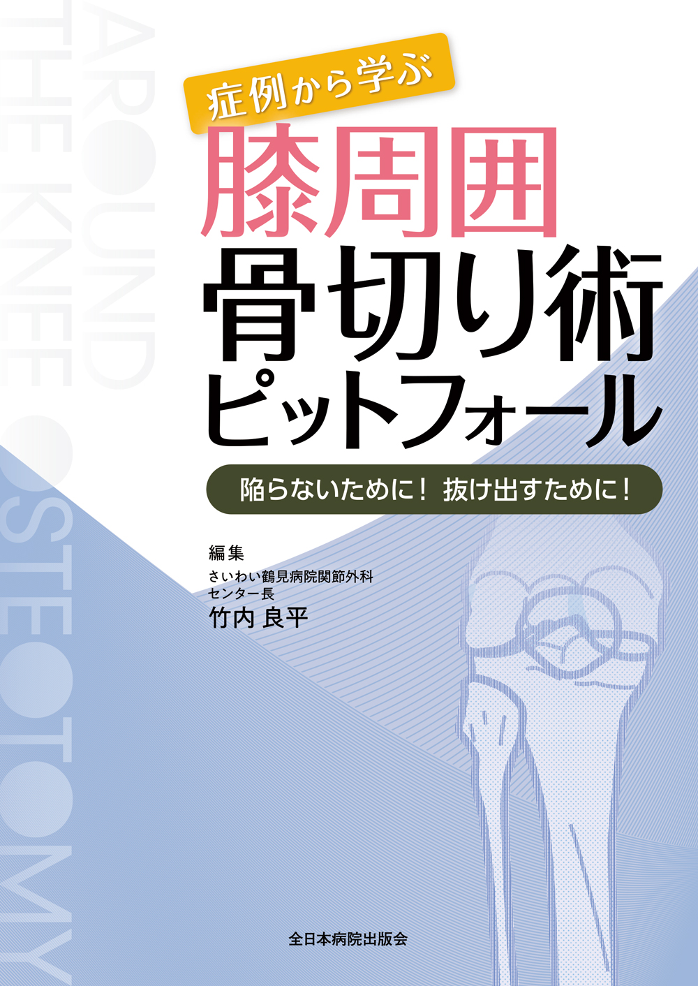 膝周囲骨切り術 | 医書.jp