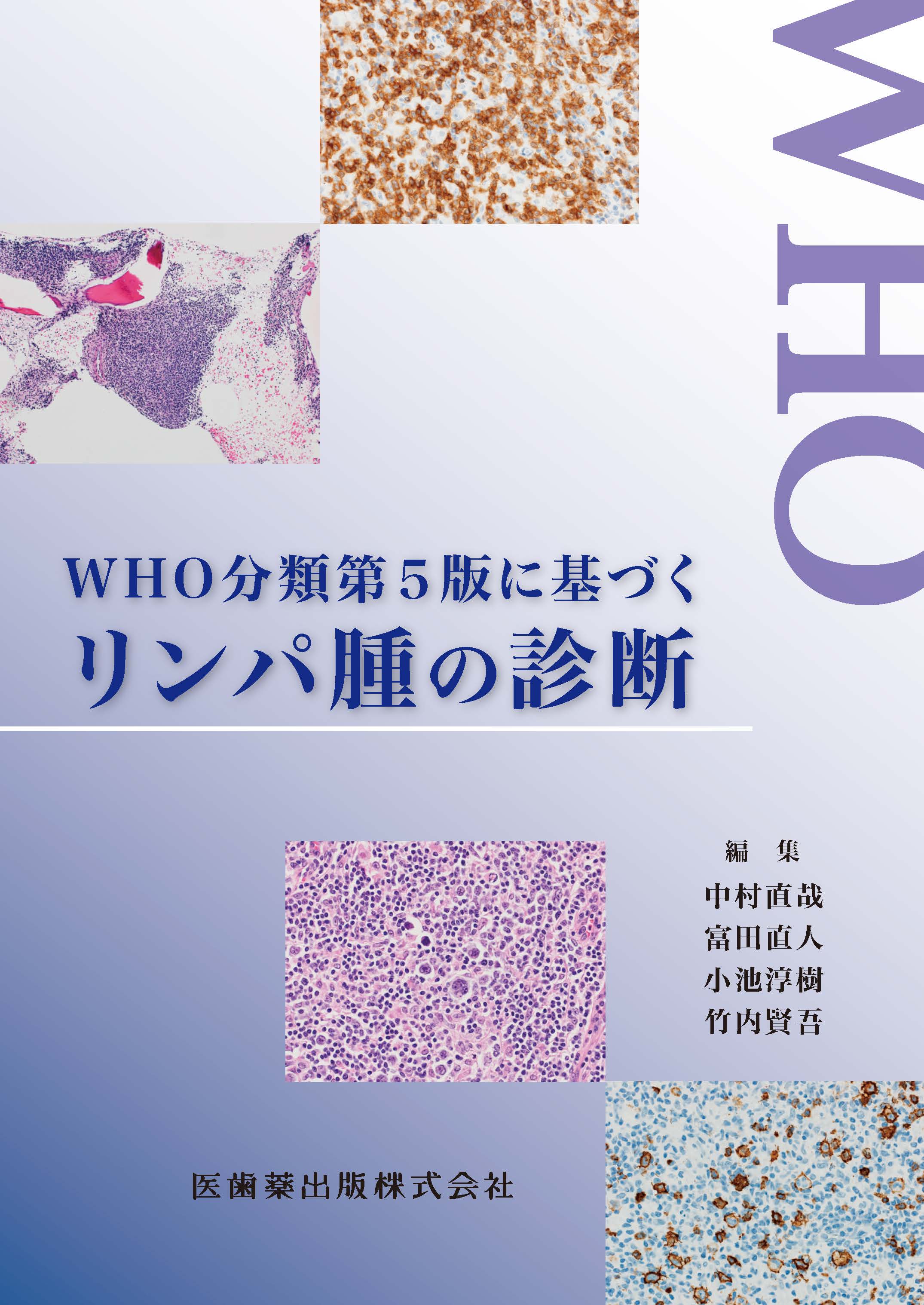 WHO分類第5版に基づくリンパ腫の診断 | 医書.jp