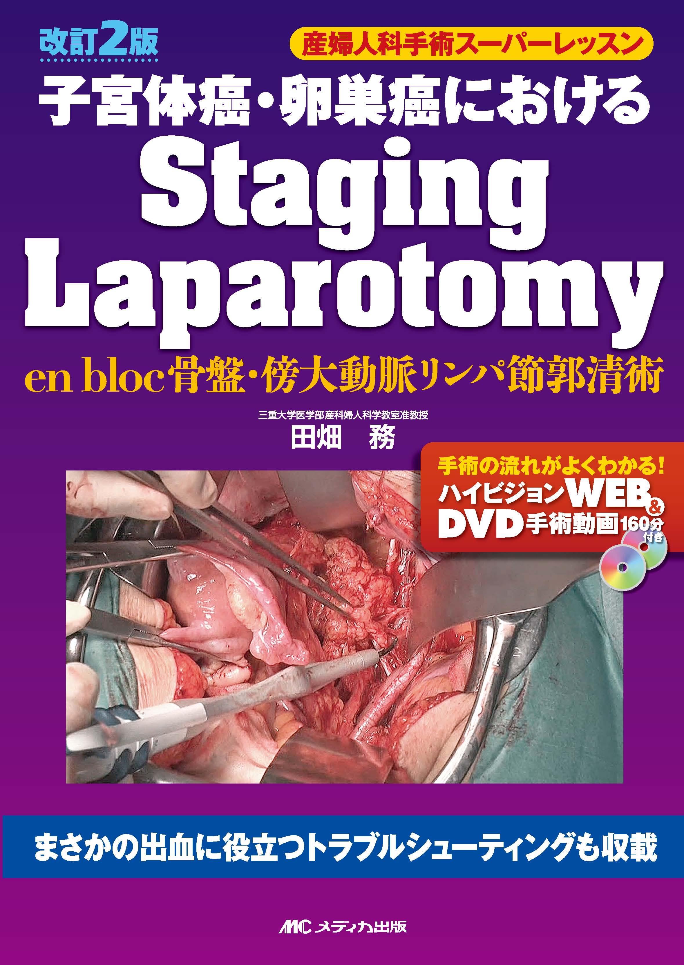 改訂2版 子宮体癌・卵巣癌におけるStaging Laparotomy | 医書.jp