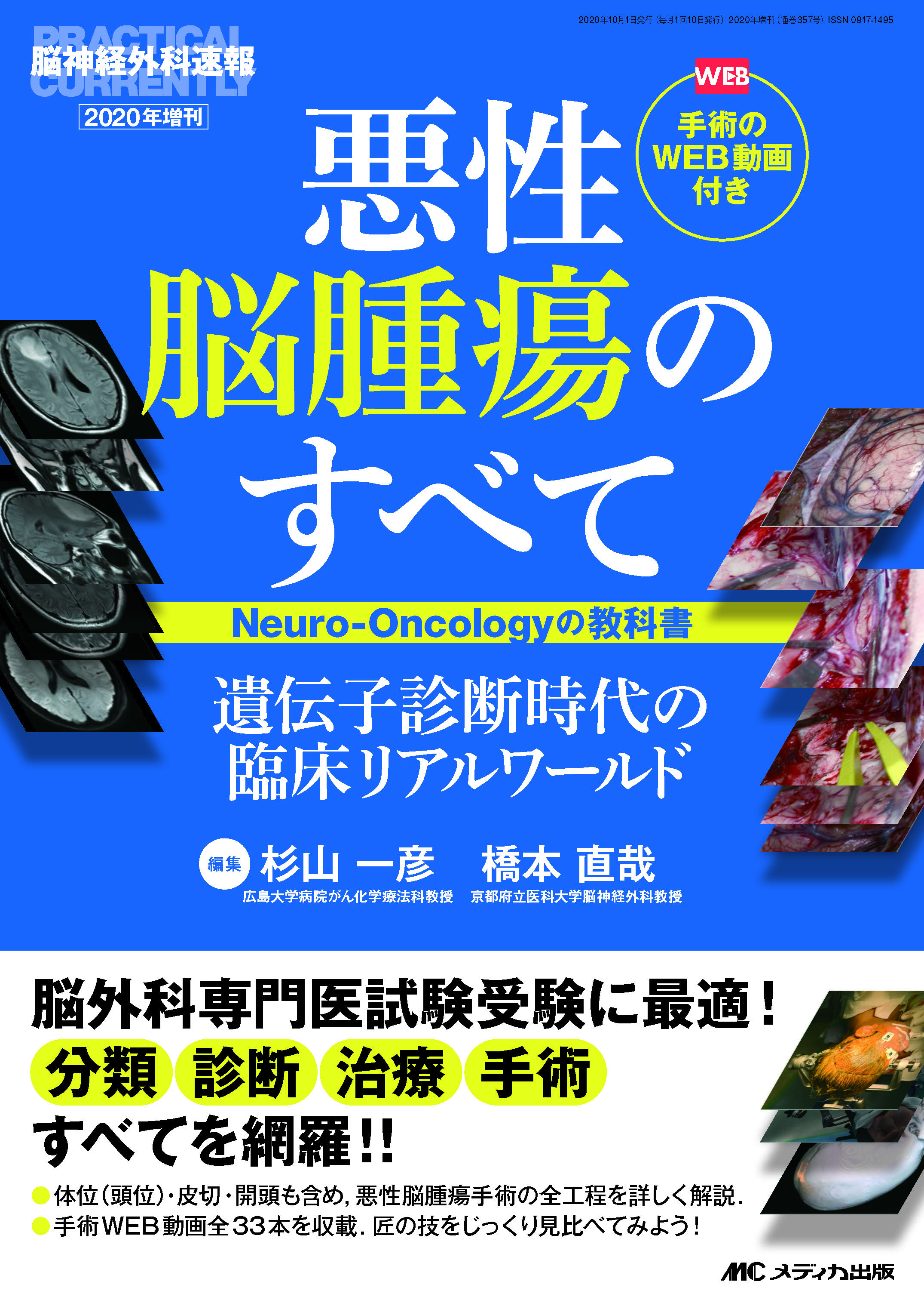 悪性脳腫瘍のすべて ―Neuro-Oncologyの教科書― | 医書.jp