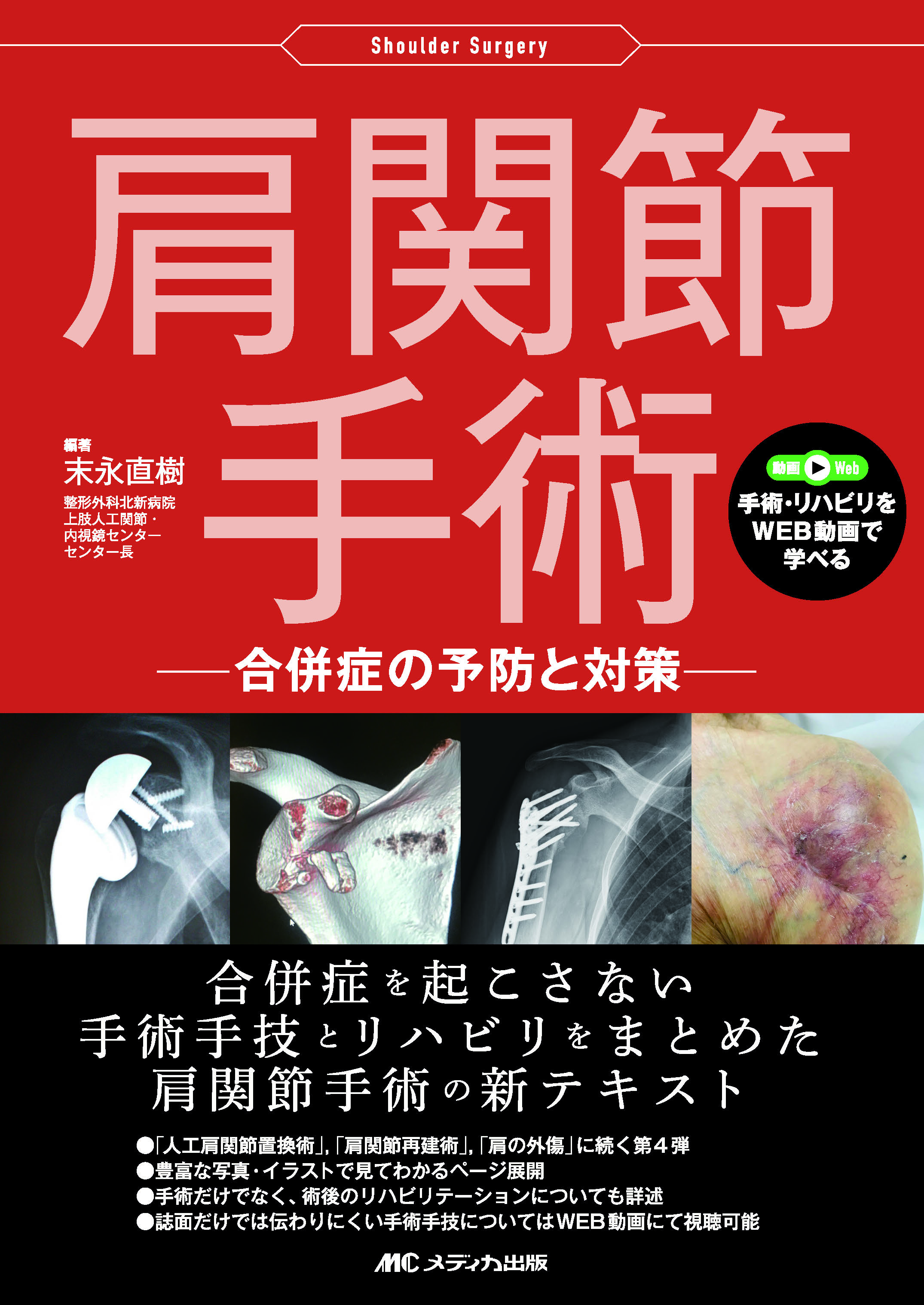 肩関節手術 | 医書.jp