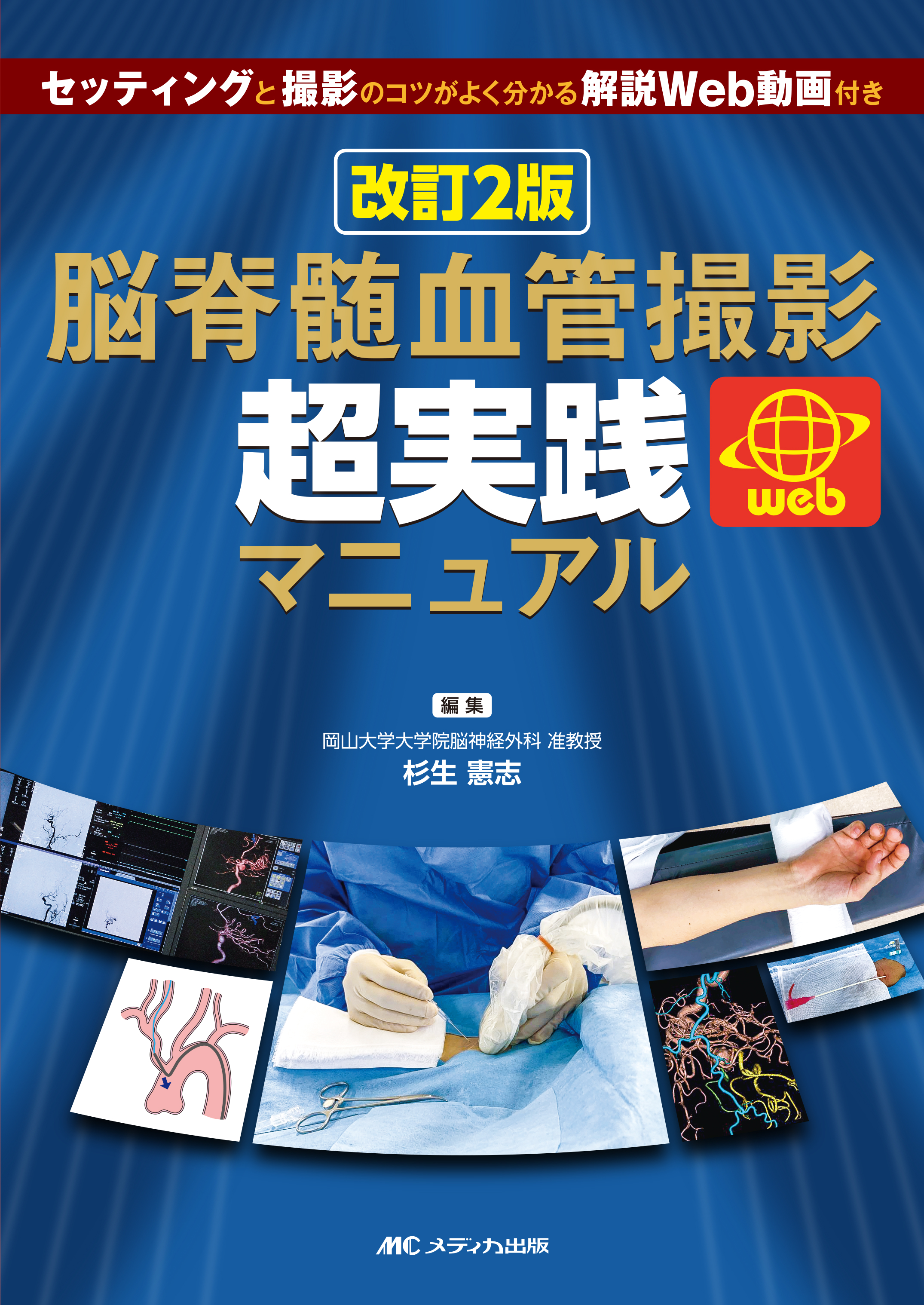 改訂2版 脳脊髄血管撮影 超実践マニュアル | 医書.jp