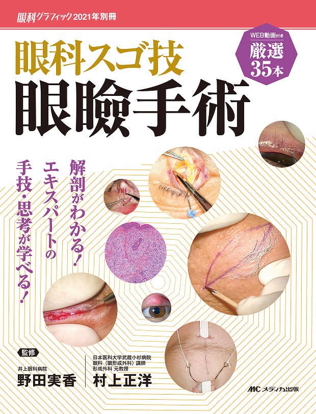 眼科スゴ技 眼瞼手術 | 医書.jp