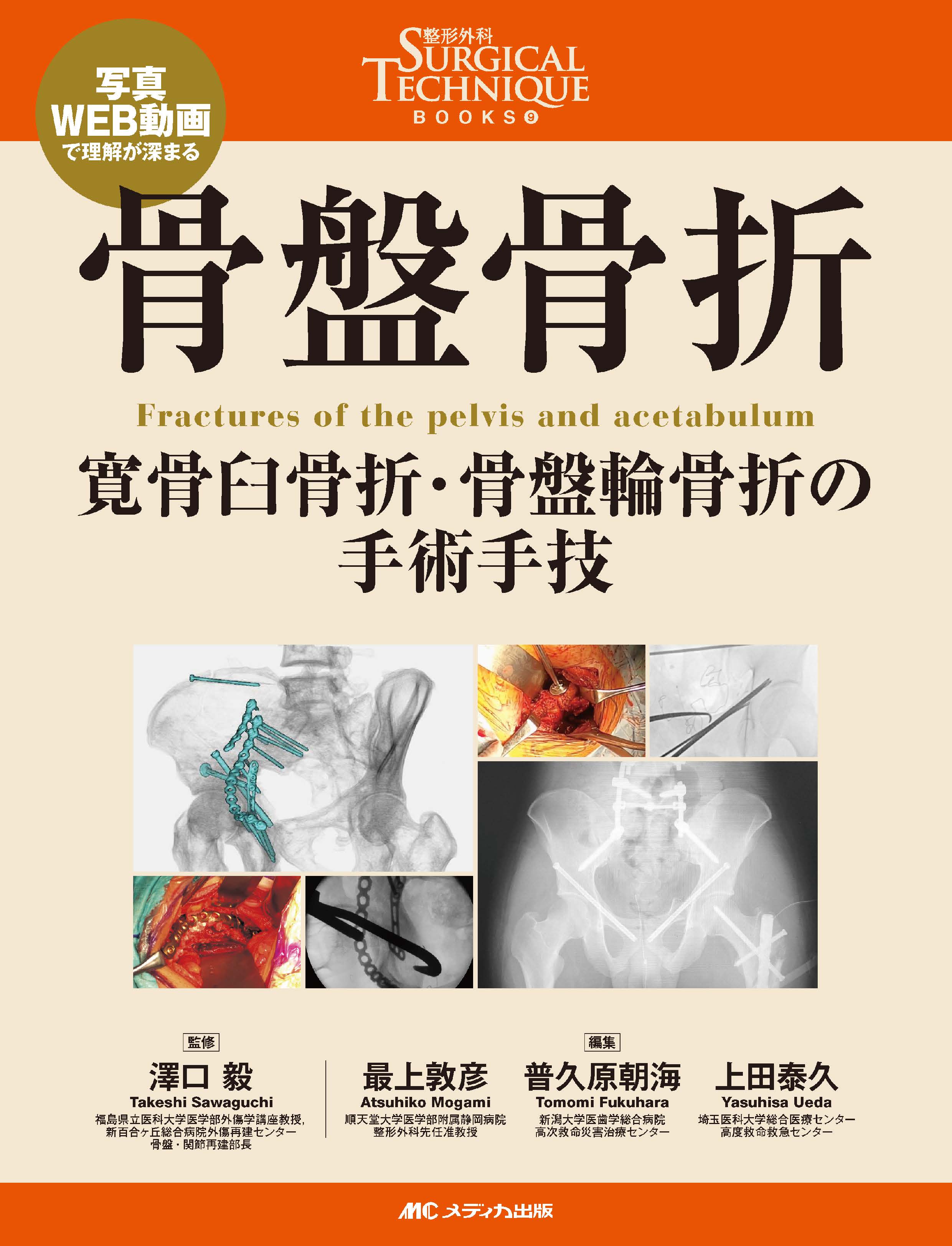 骨盤骨折 | 医書.jp