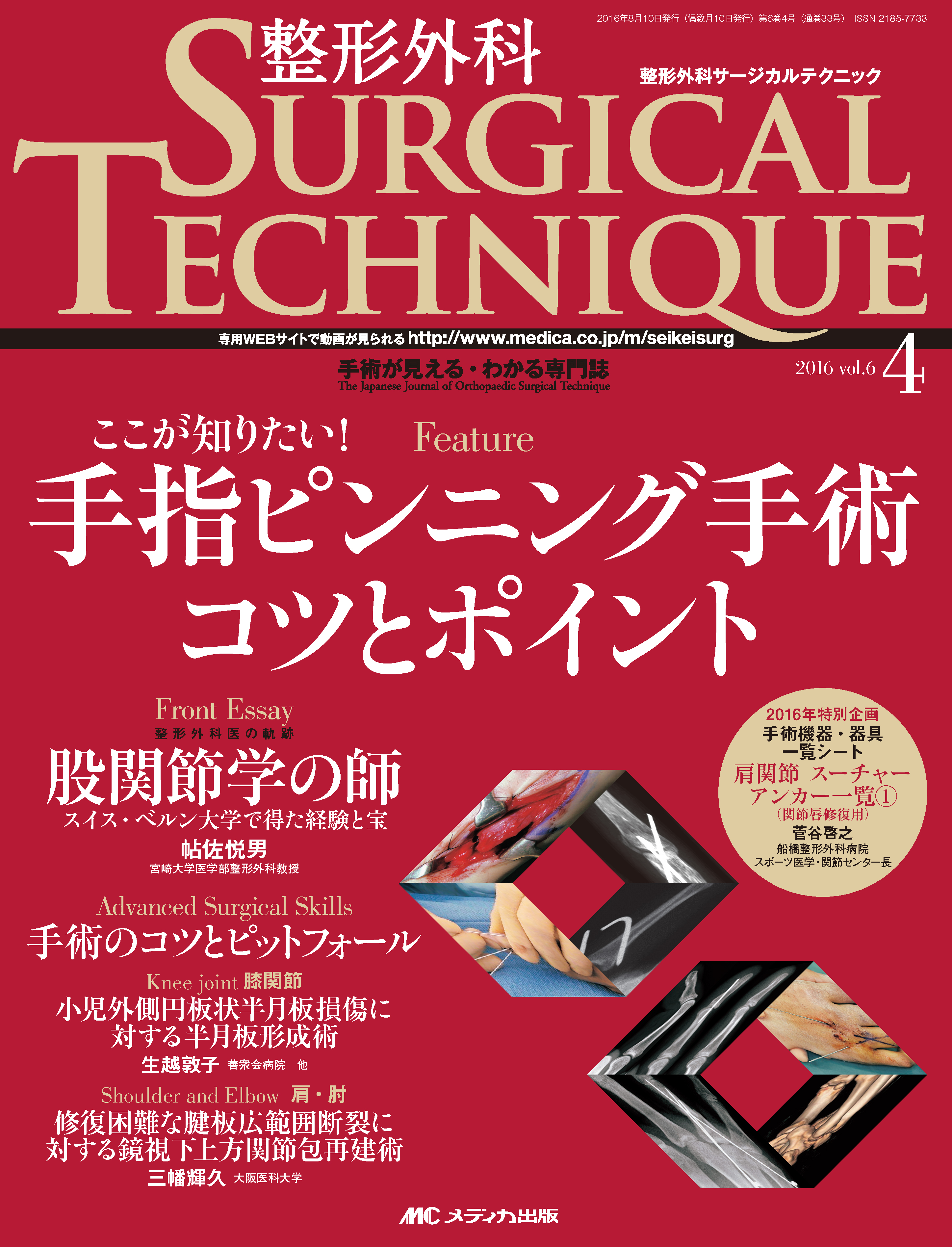 整形外科 SURGICAL TECHNIQUE（サージカルテクニック） 2016年4号