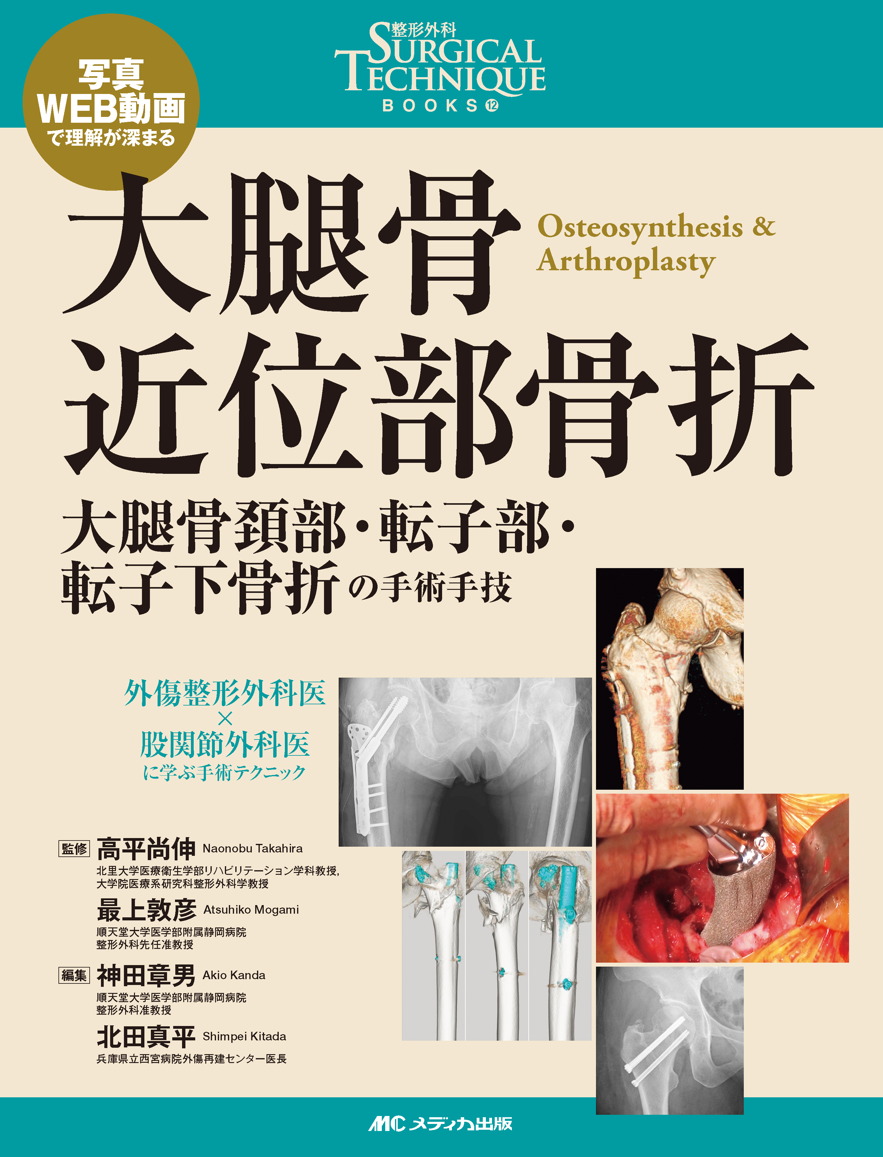 大腿骨近位部骨折 大腿骨近位部骨折 | 医書.jp