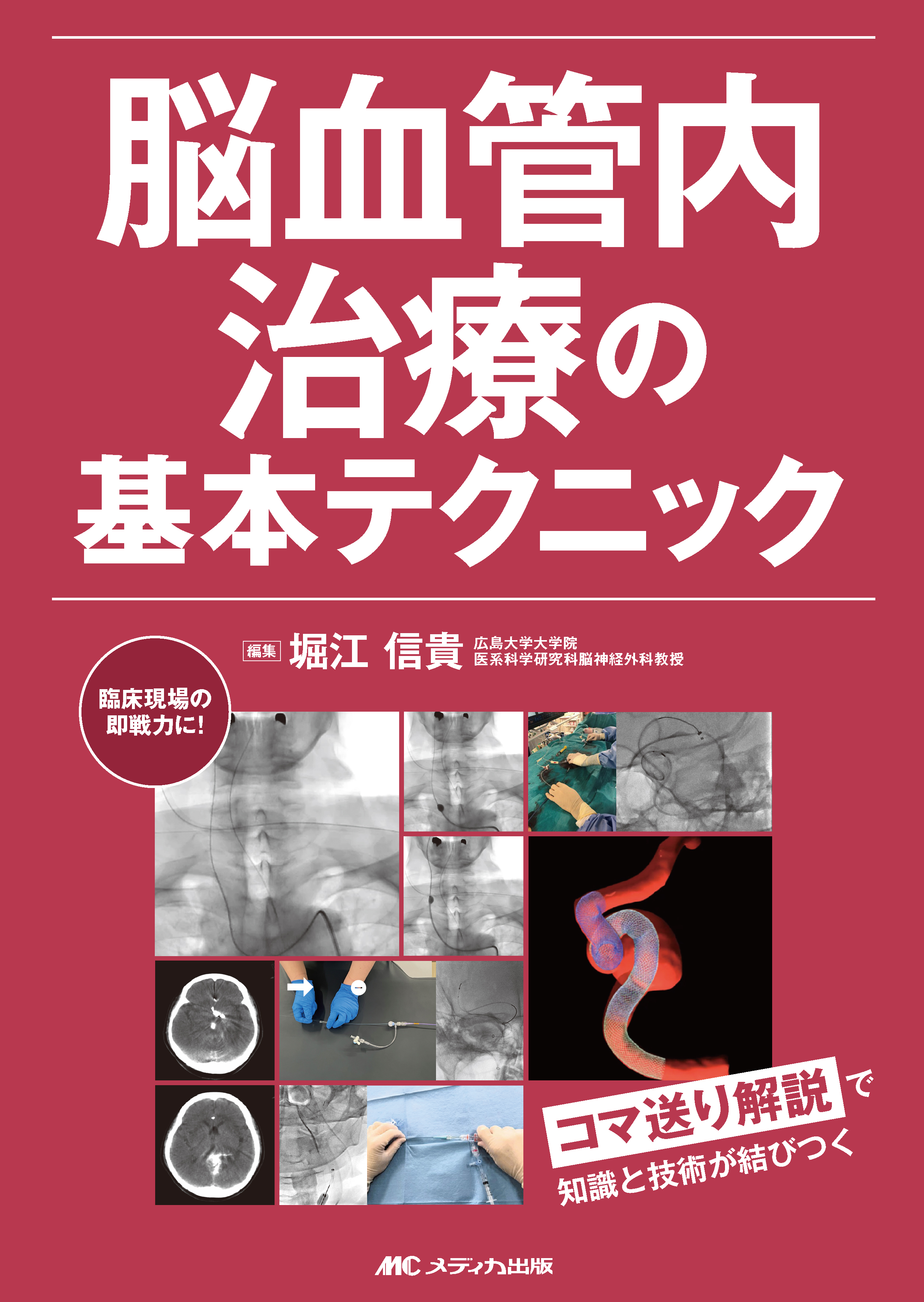 脳血管内治療の基本テクニック | 医書.jp