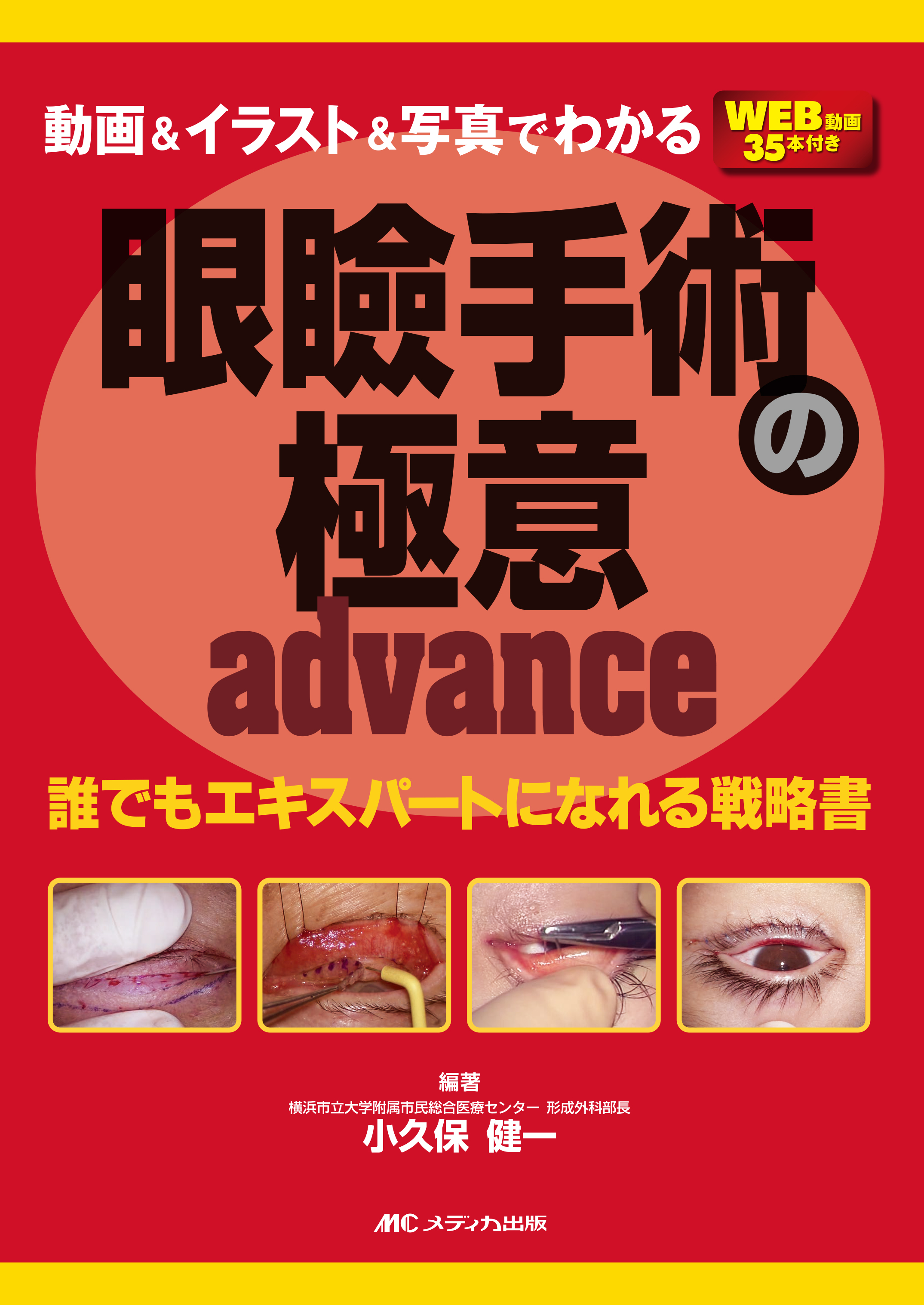 【g】外鼻形成術、眼瞼手術の極意 動画＆イラスト＆写真でわかる 眼瞼手術の極意 advance | 医書.jp